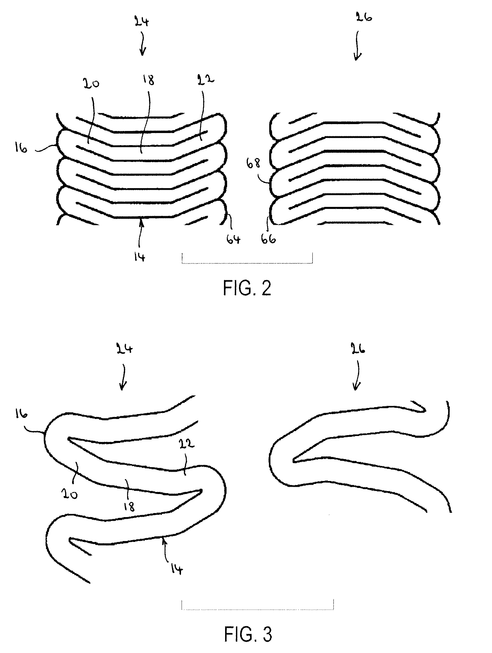 Endoprosthesis having rings linked by foot extensions