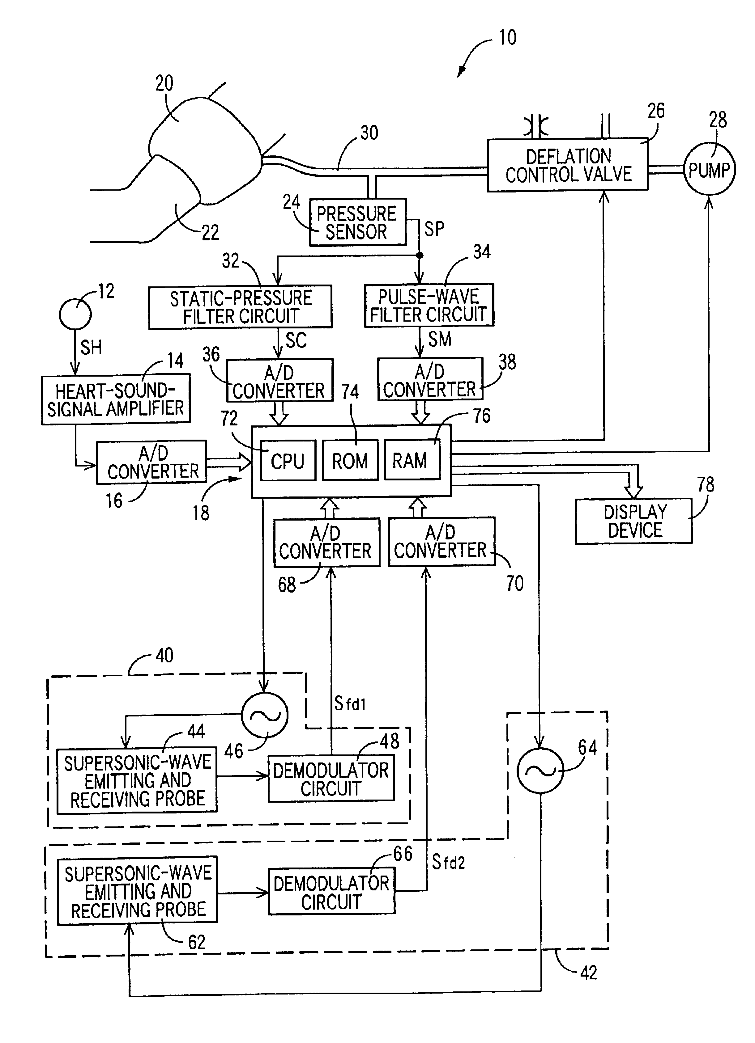 Angiopathy diagnosing apparatus