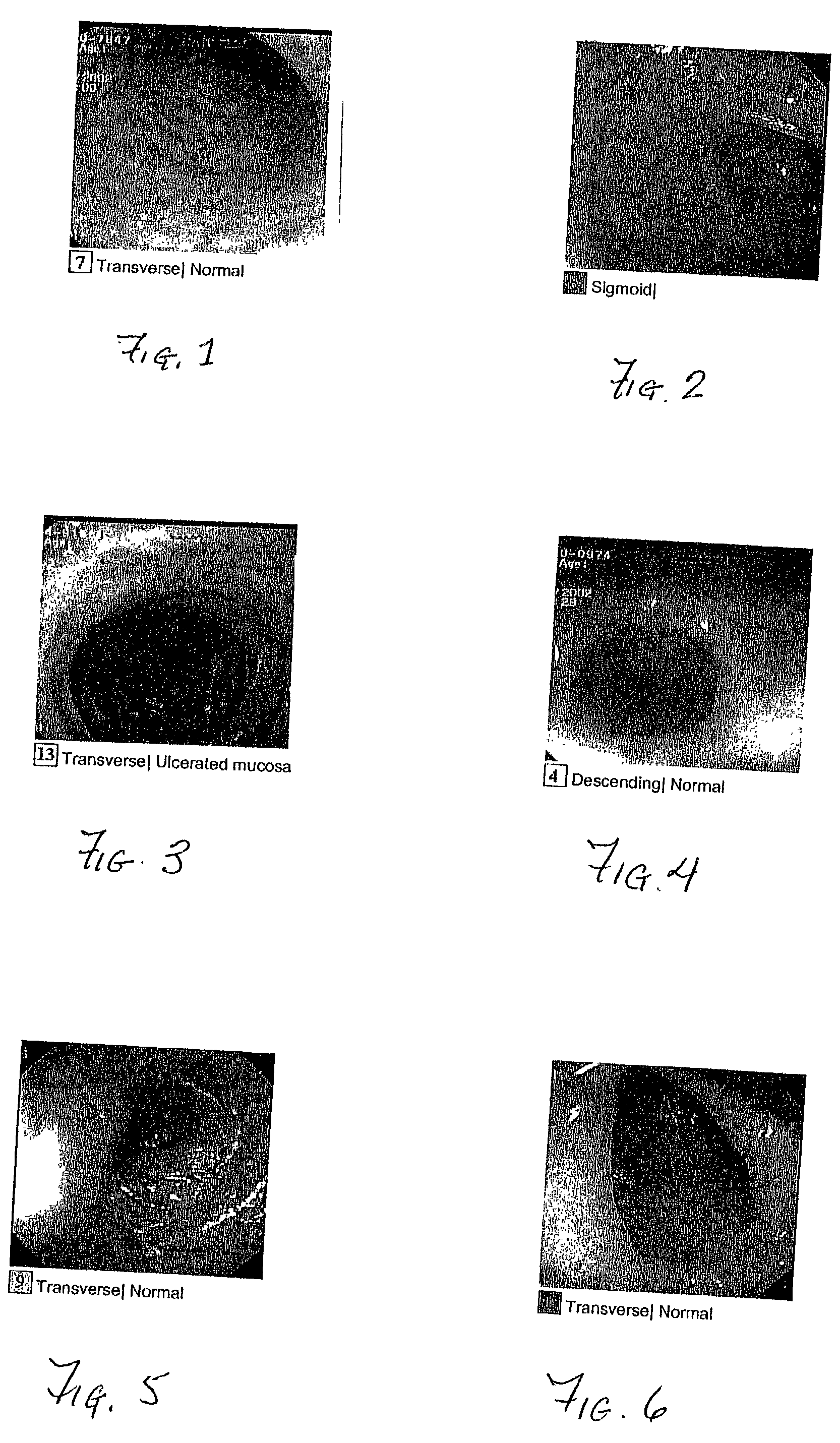 Bowel cleansing composition