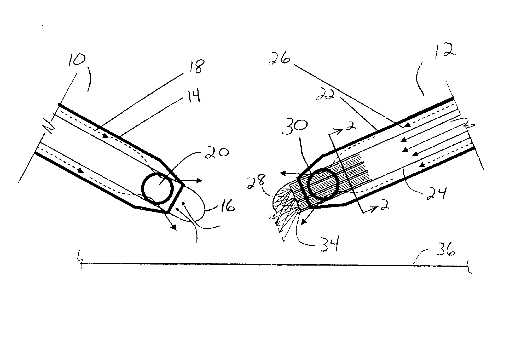 Surgical method and apparatus