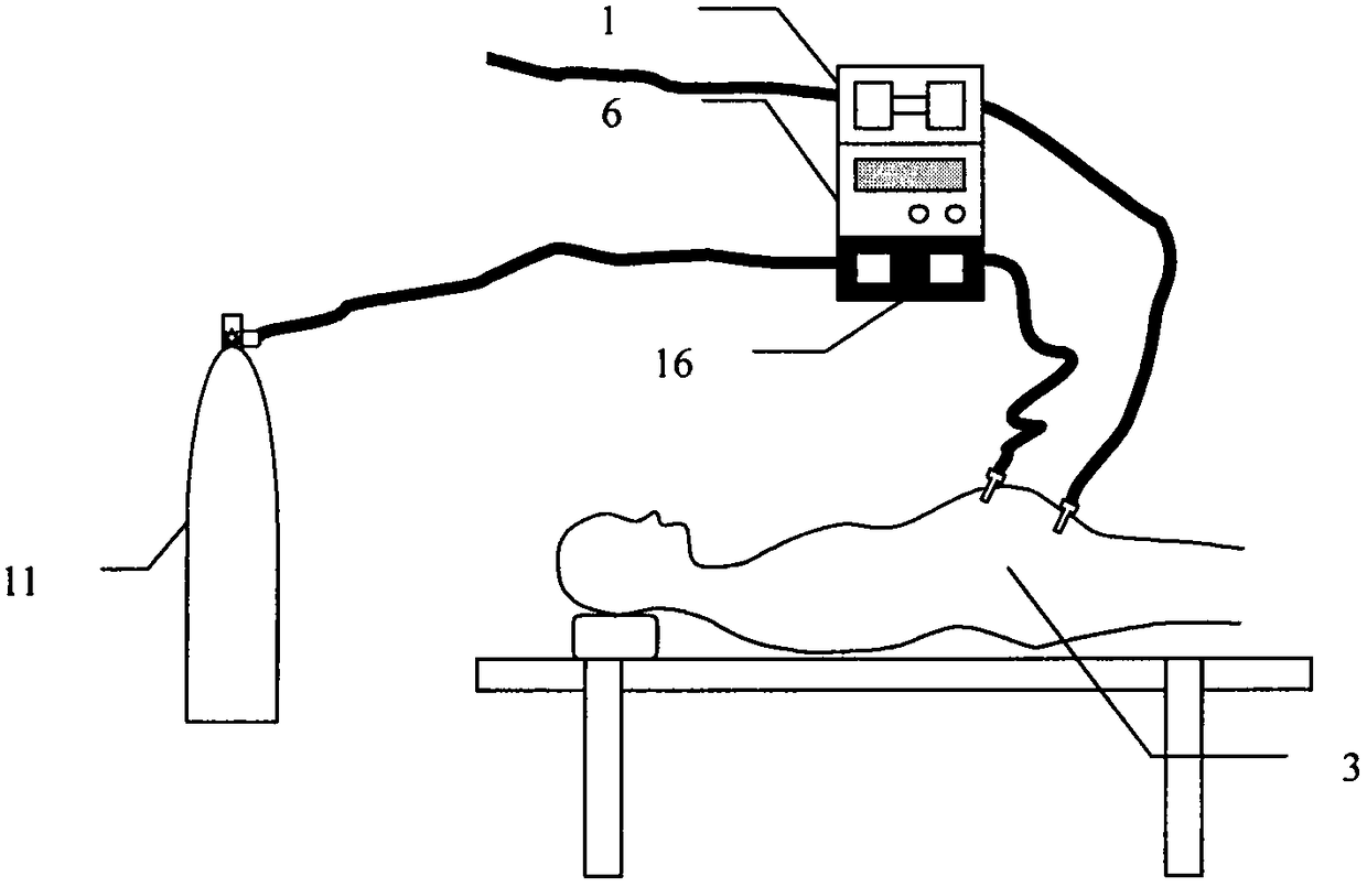 Special constant-temperature pneumoperitoneum system for oncological surgery department