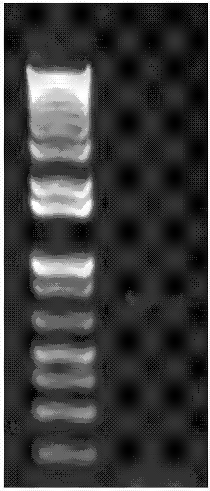 TRAIL secretion mesenchyma stem cell and purpose thereof for encephaloma treatment