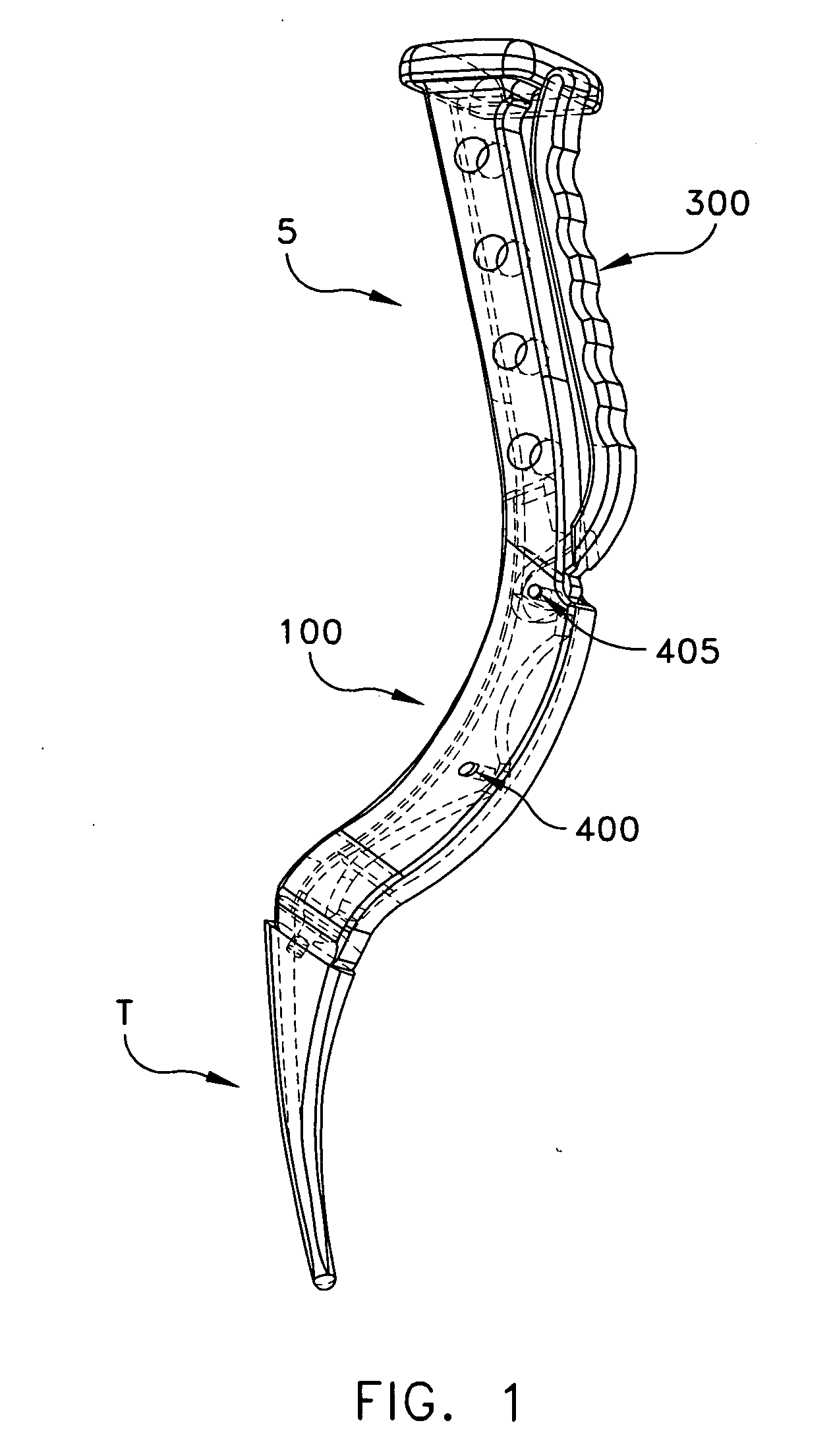 Broach handle for minimally invasive hip replacement surgery