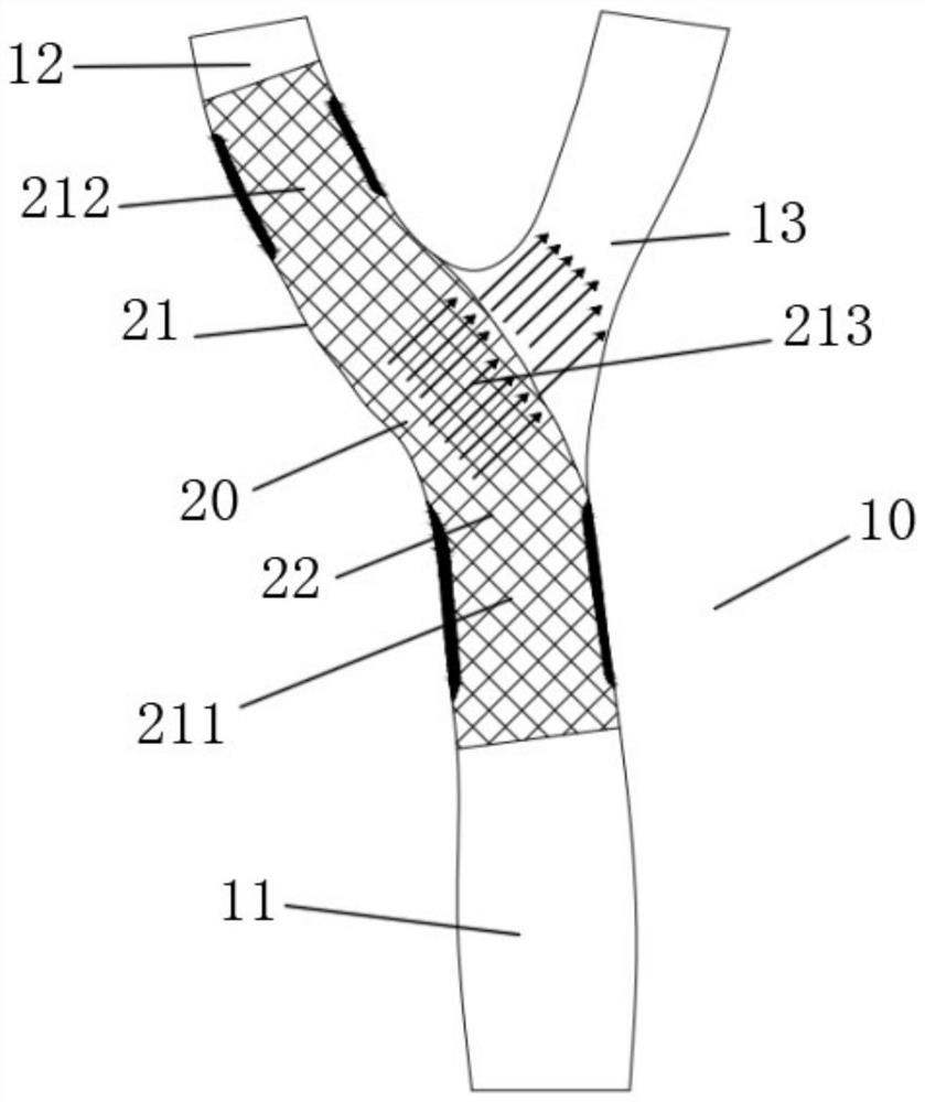 Variable-aperture covered stent