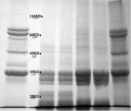 Composite high peptidergic biological protein feed and preparation method thereof