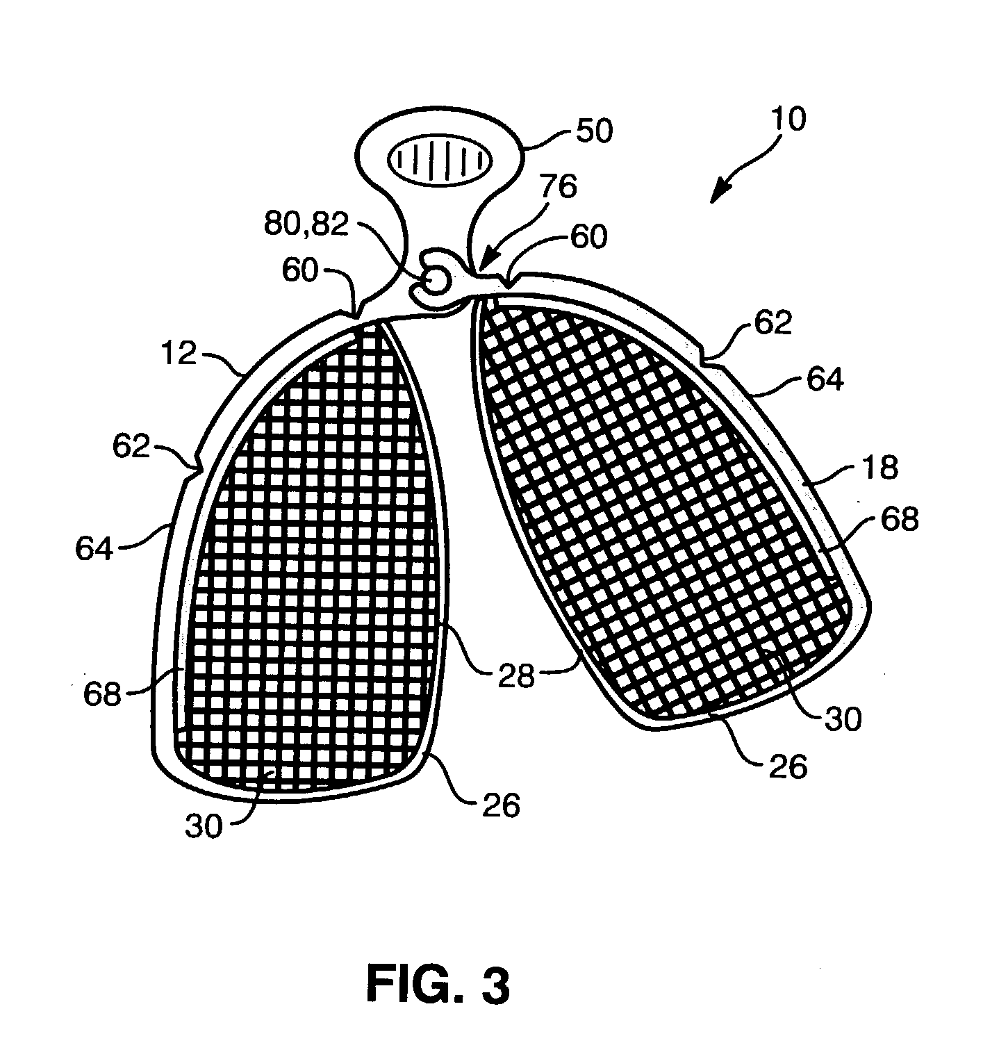 Adjustable dental impression tray and methods for using same