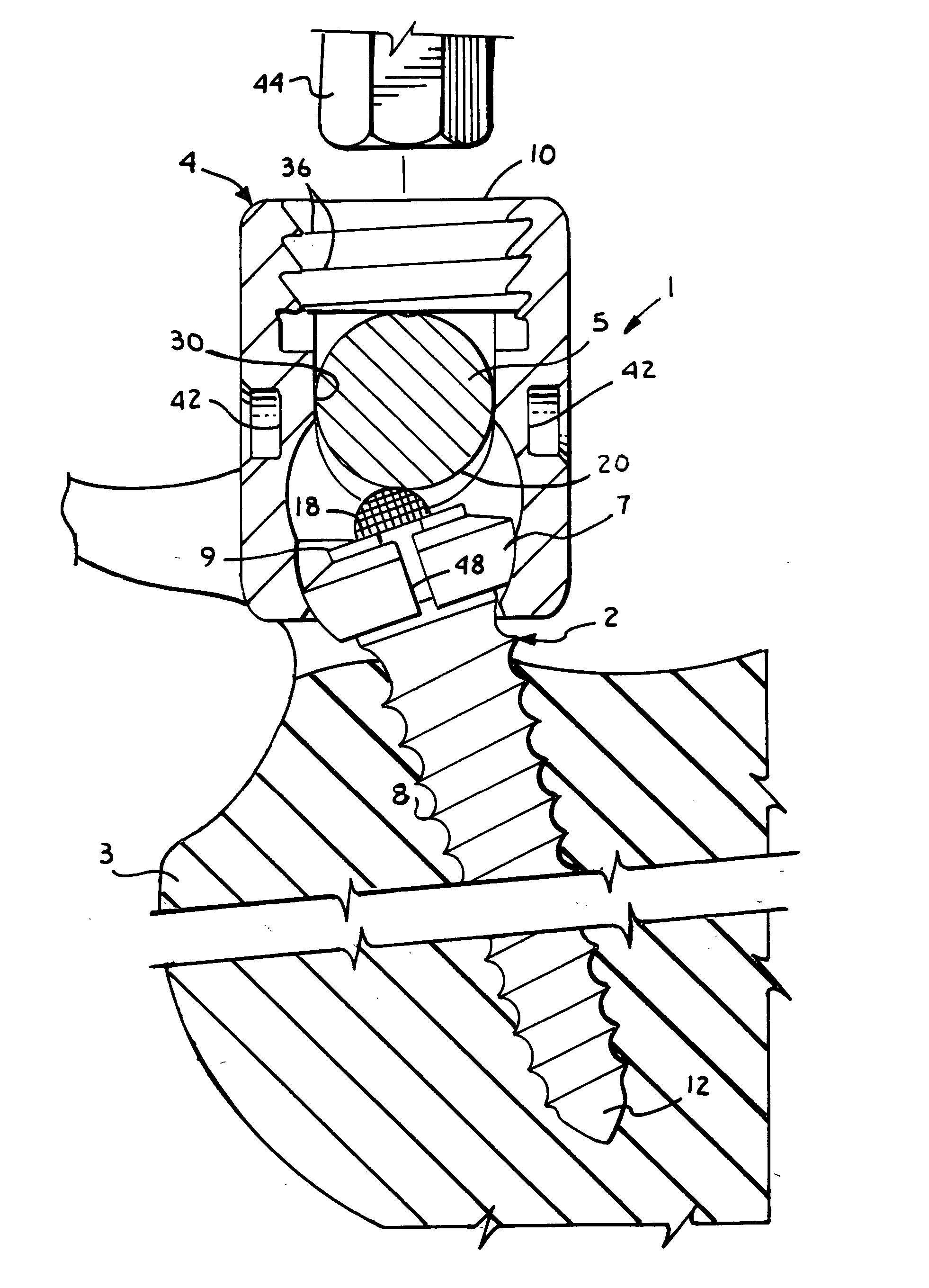 Polyaxial bone screw with split retainer ring