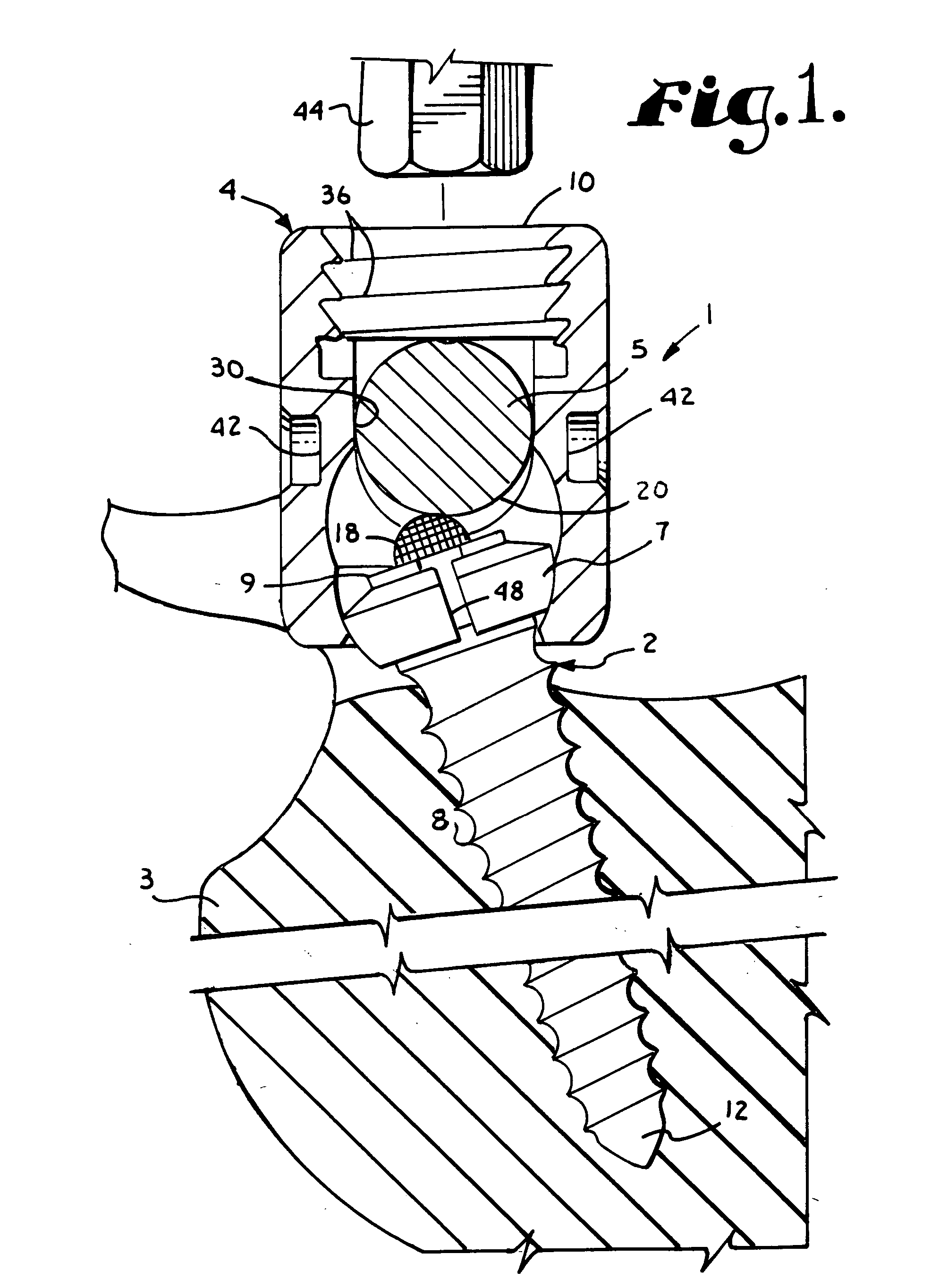 Polyaxial bone screw with split retainer ring