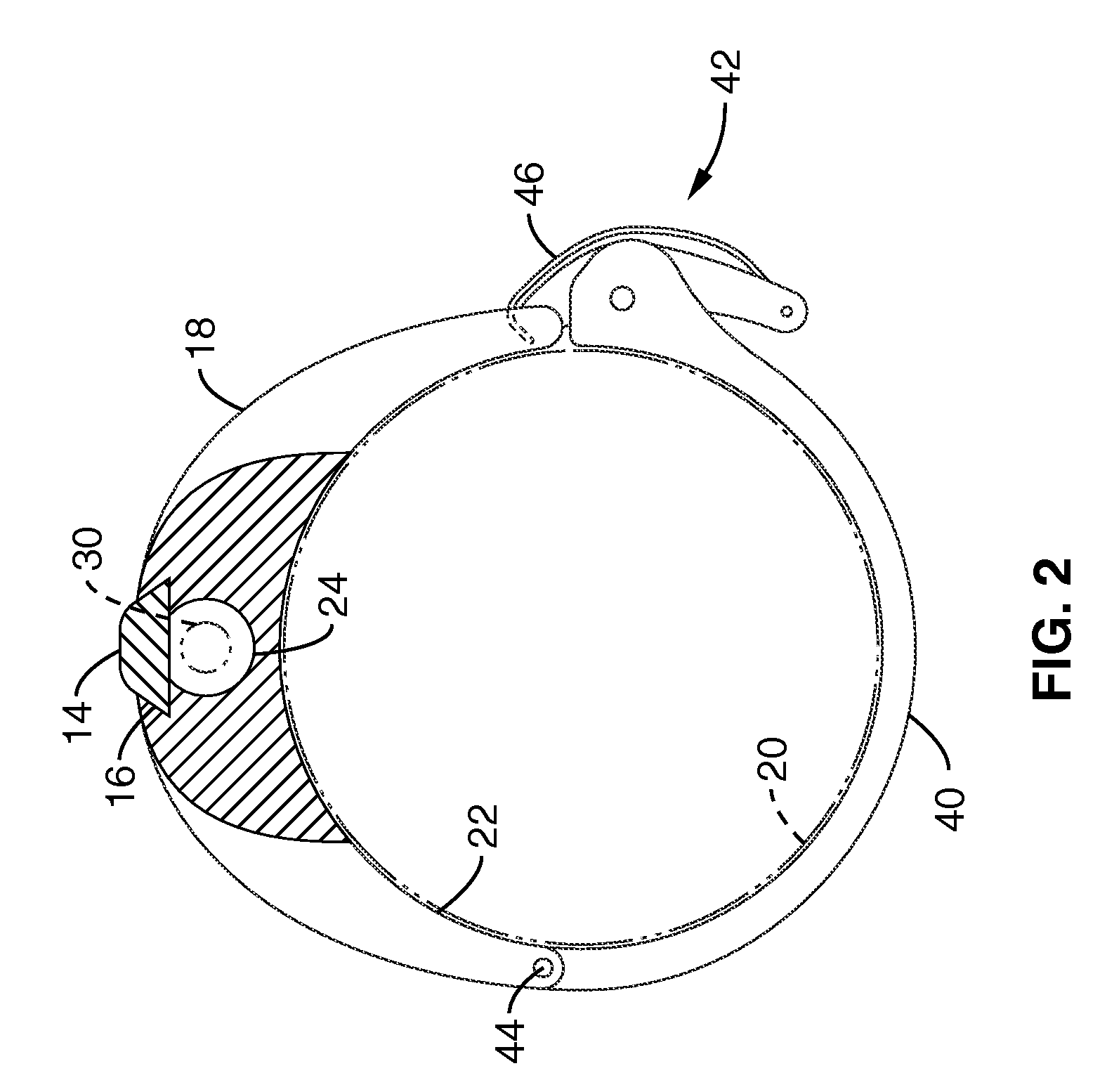 Sonographically guided transvaginal or transrectal pelvic abscess drainage using trocar method and biopsy guide attachment