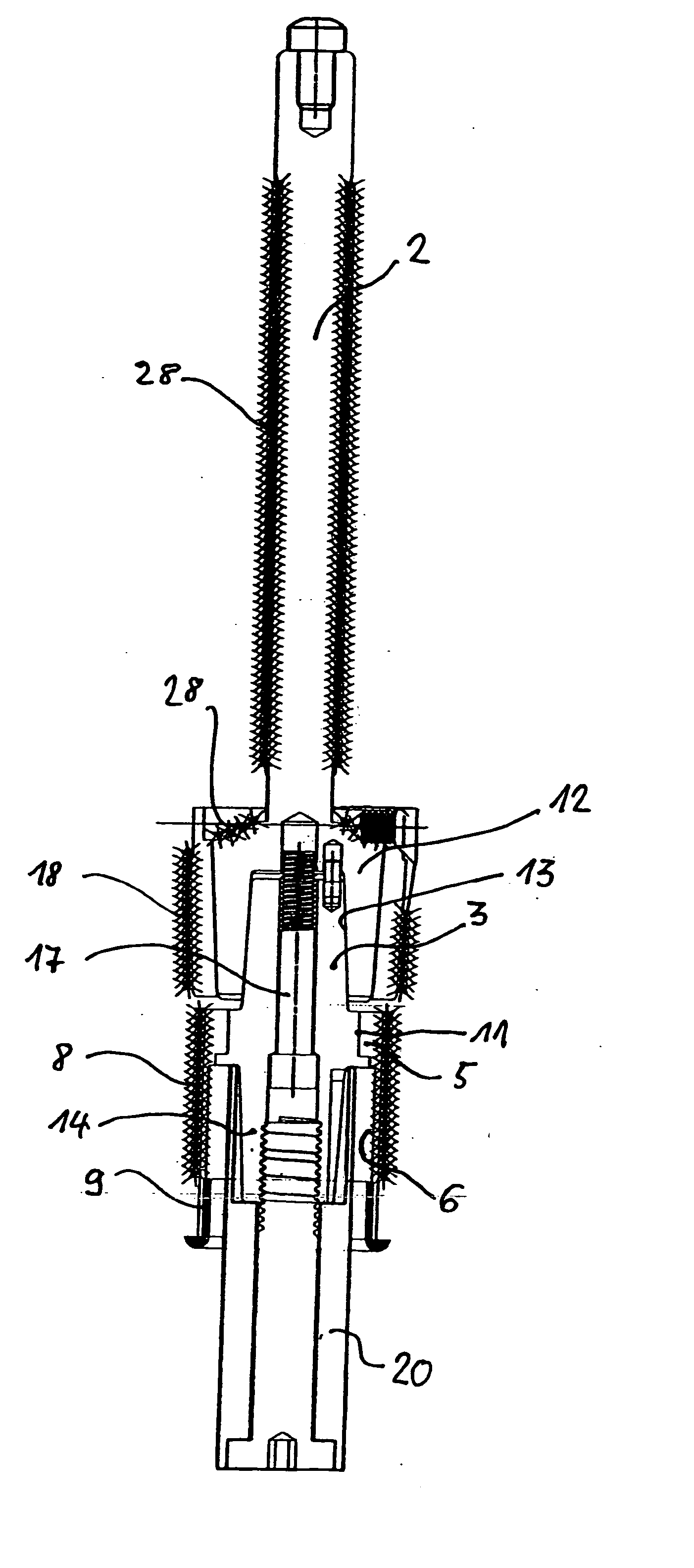 Subcutaneous, intramuscular bearing for a rigid transcutaneous implant