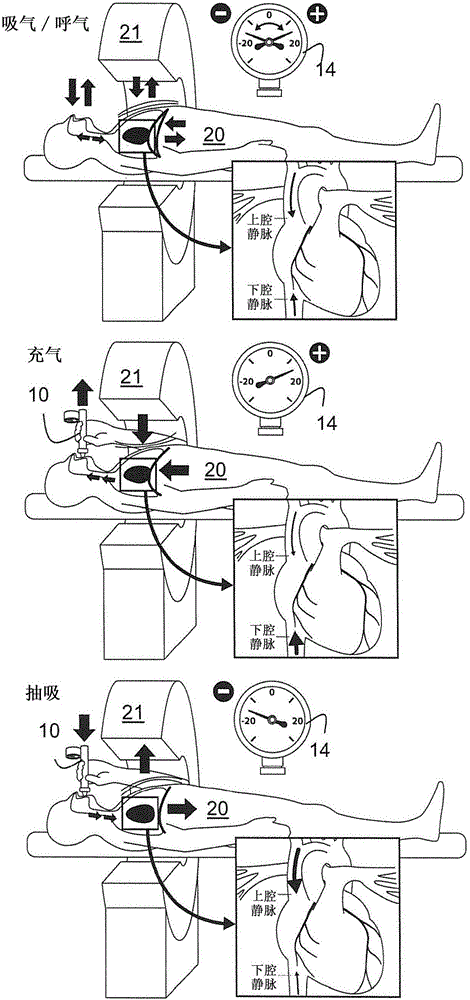 Blood flow control system and methods for in-vivo imaging and other applications