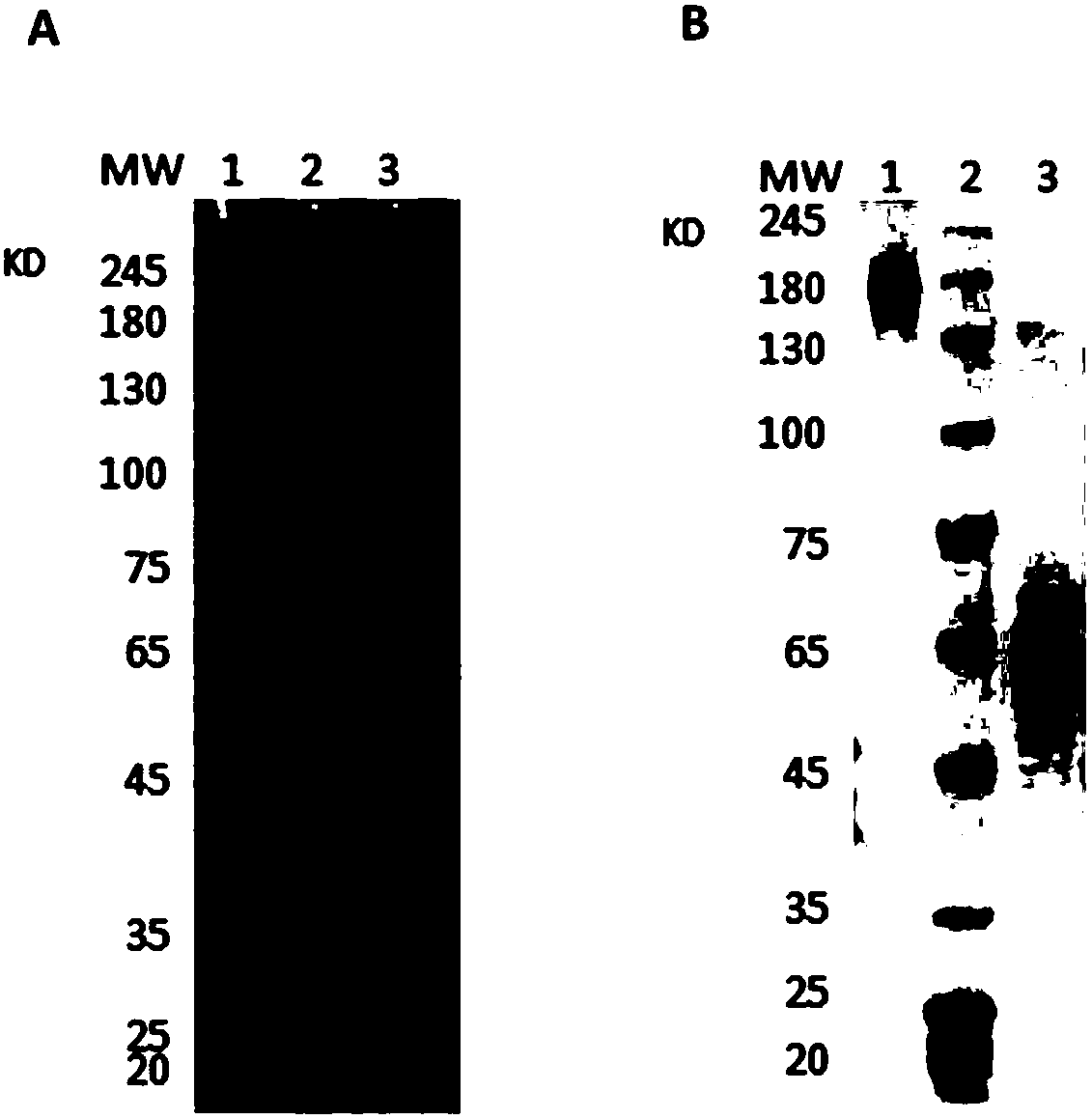 Completely humanized monoclonal neutralizing antibody for tetanus toxin and application of neutralizing antibody