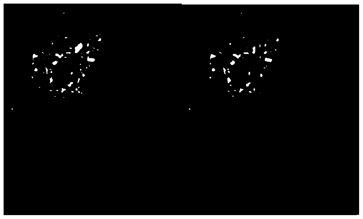 Cancer cell detection method based on Faster R-CNN and density estimation