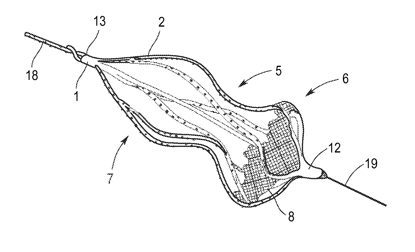 Implant for the closing of defect openings in the body of a human or animal and a system for the placement of such an implant