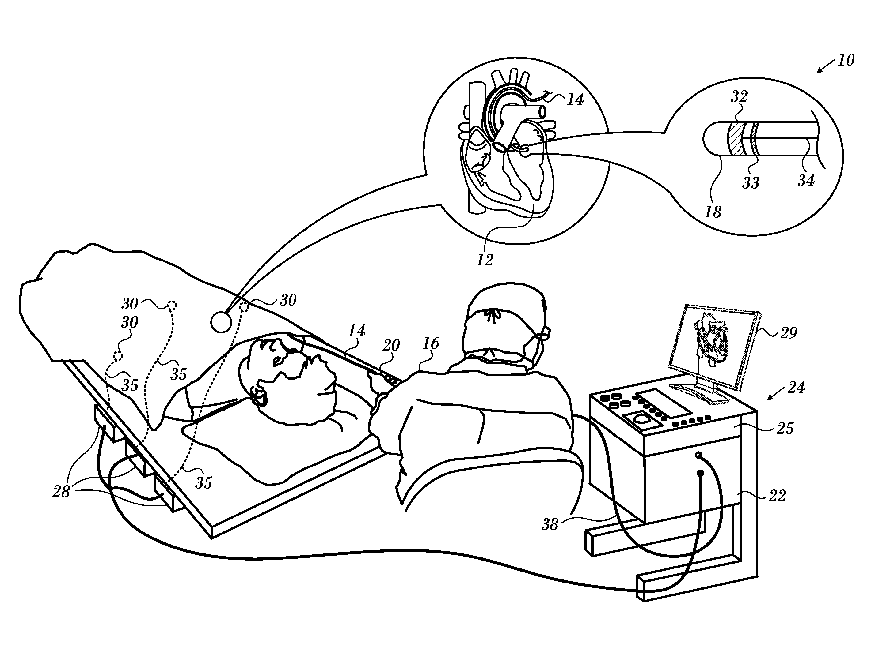 Registration maps using intra-cardiac signals