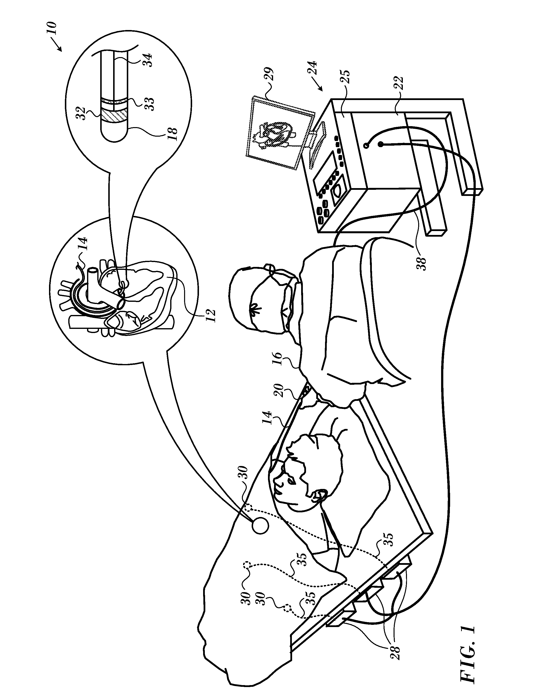 Registration maps using intra-cardiac signals