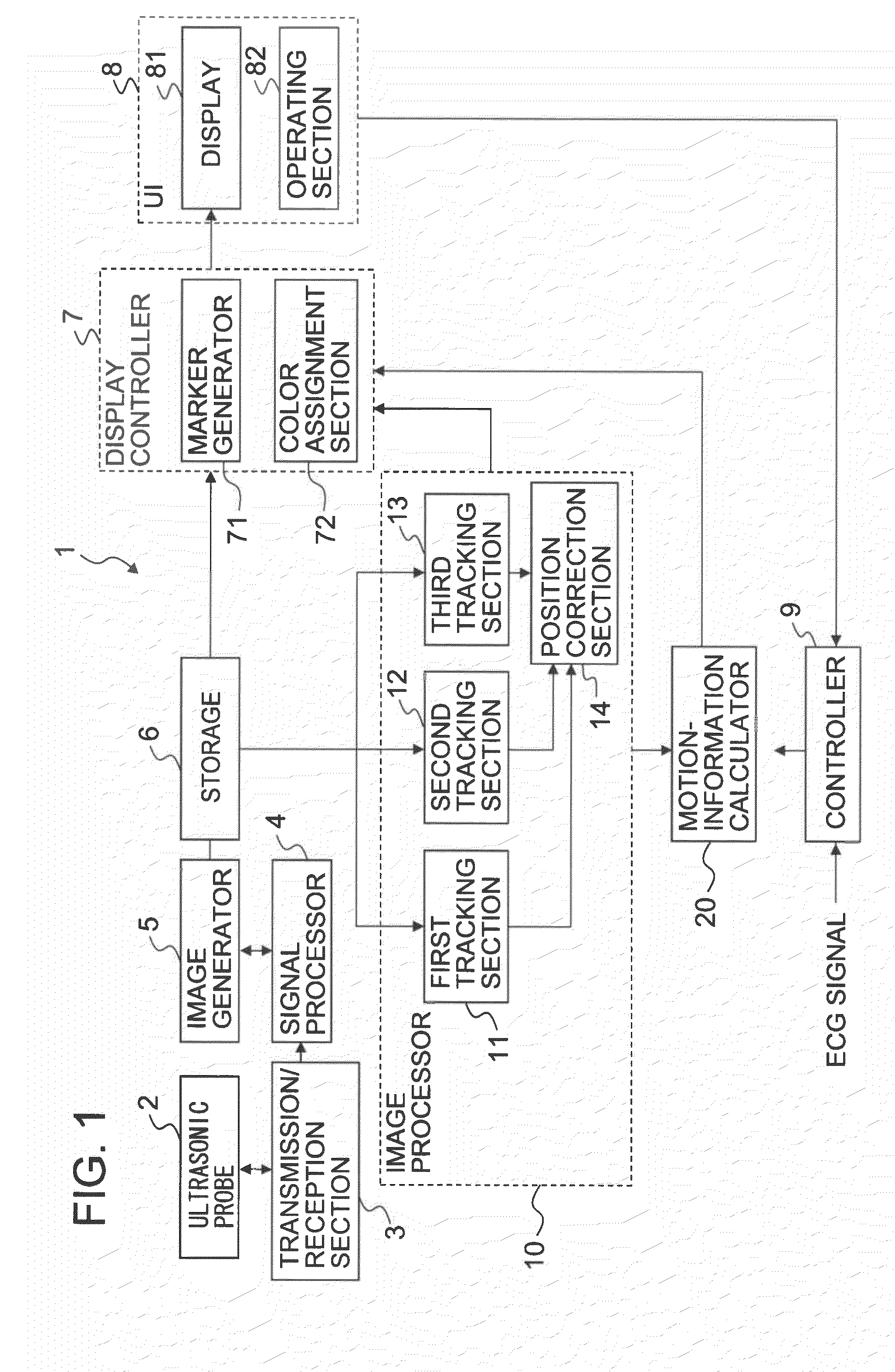 Medical imaging apparatus, medical image processing apparatus, ultrasonic imaging apparatus, ultrasonic image processing apparatus and method of processing medical images