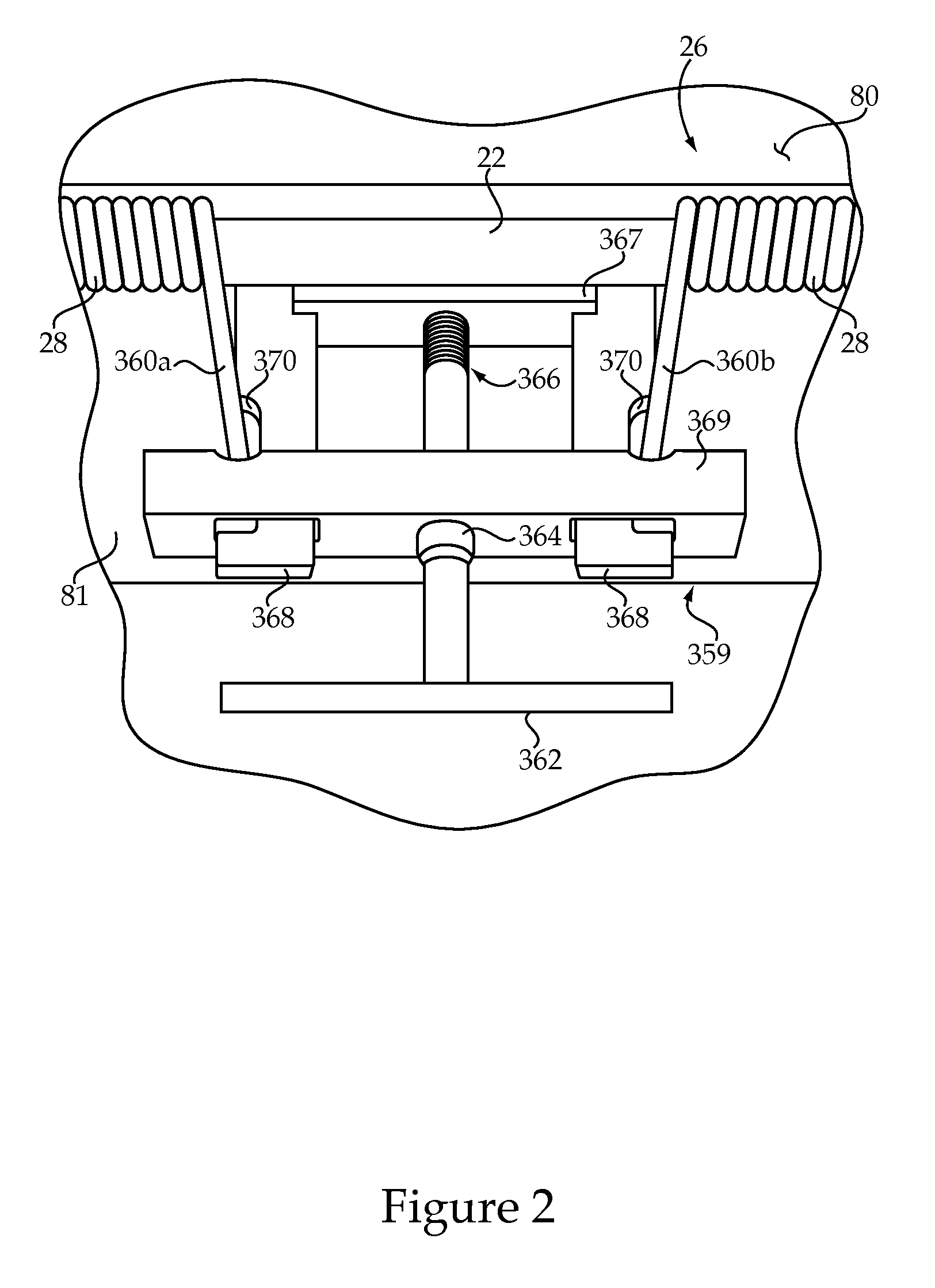 Venturi Vent Assembly For Outdoor Cookers