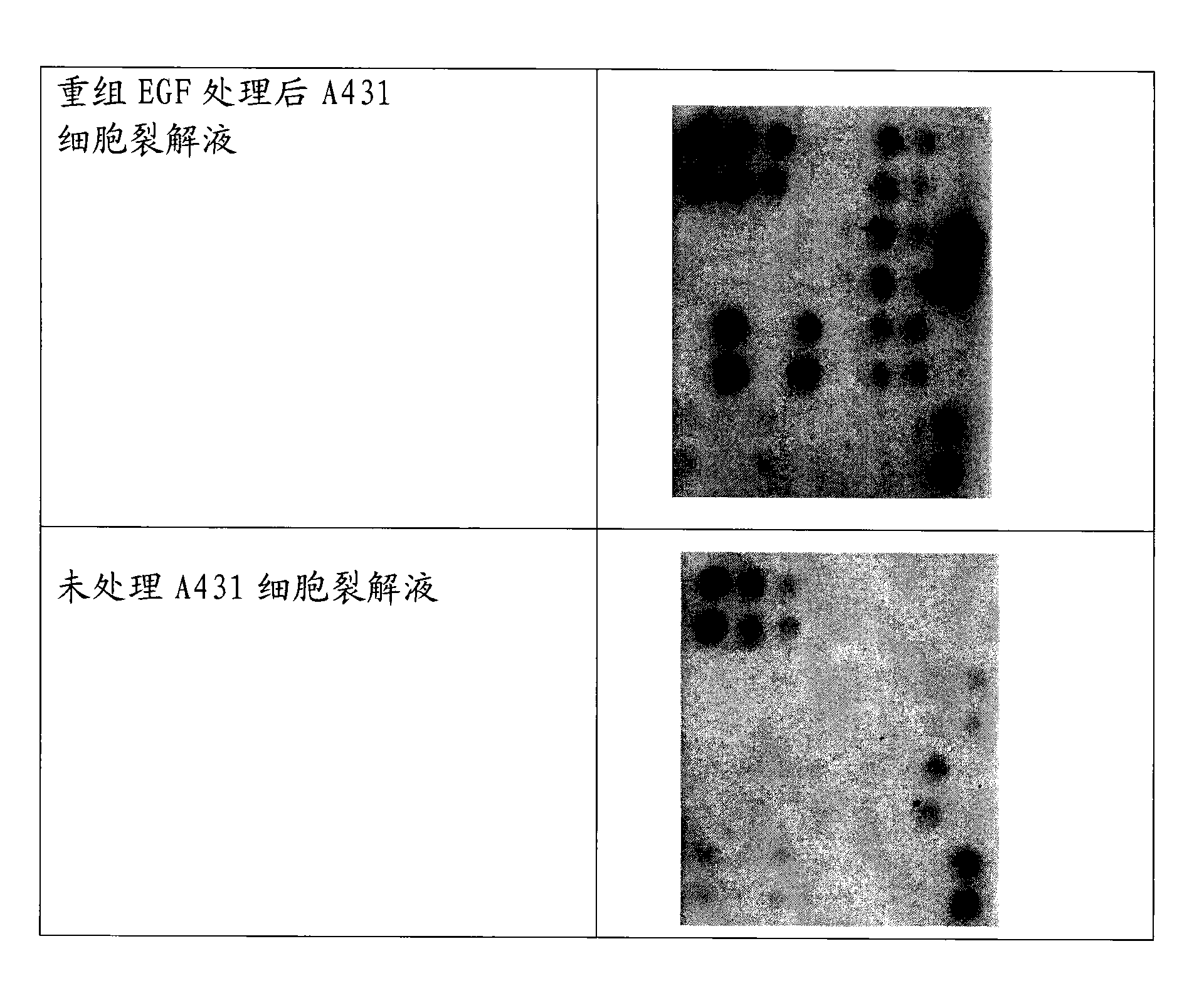 Kit for detecting phosphorylated epidermal growth factor receptor and preparation method thereof