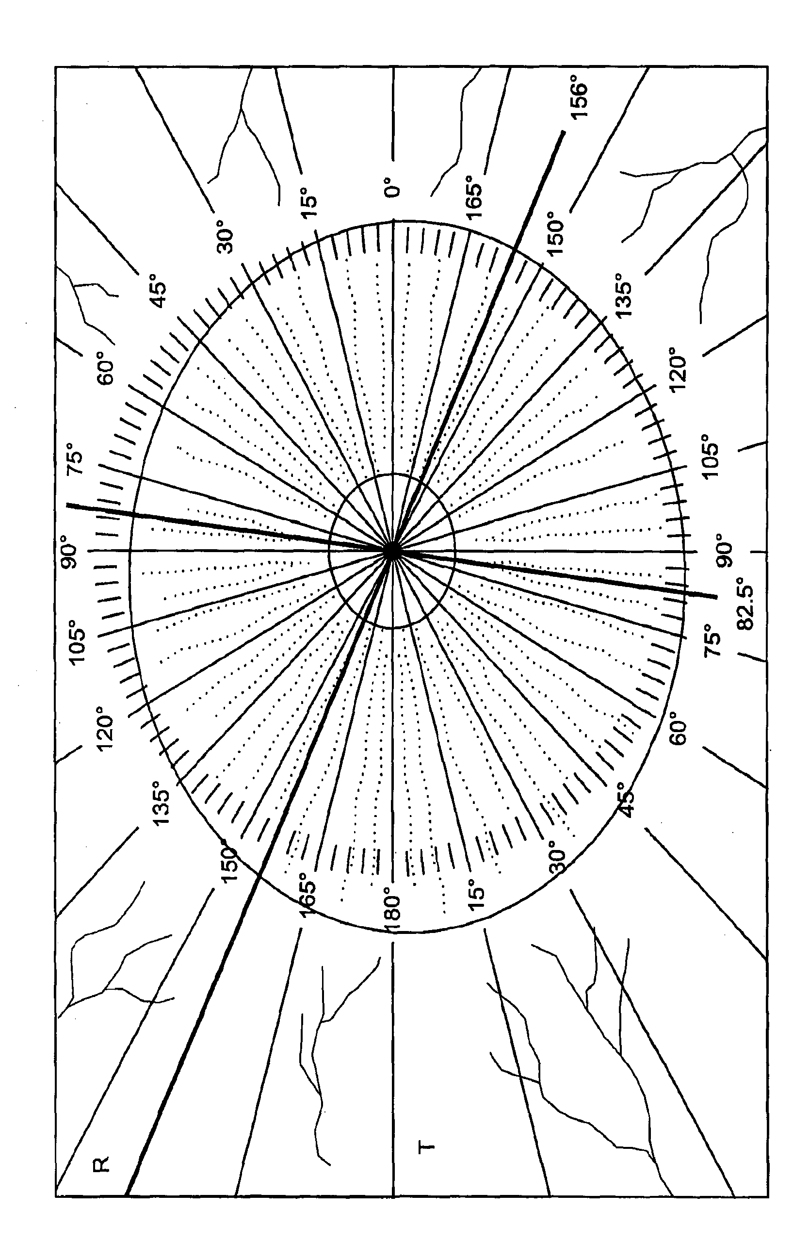 Intraocular lens alignment