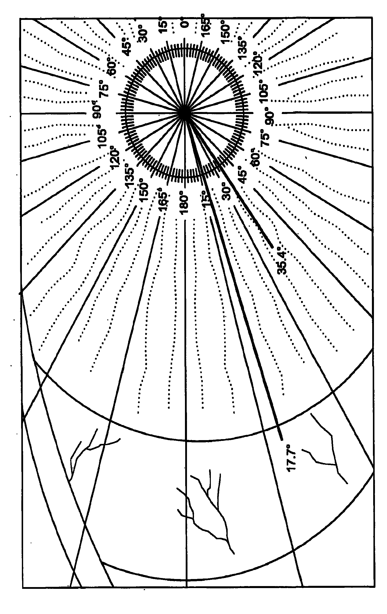 Intraocular lens alignment