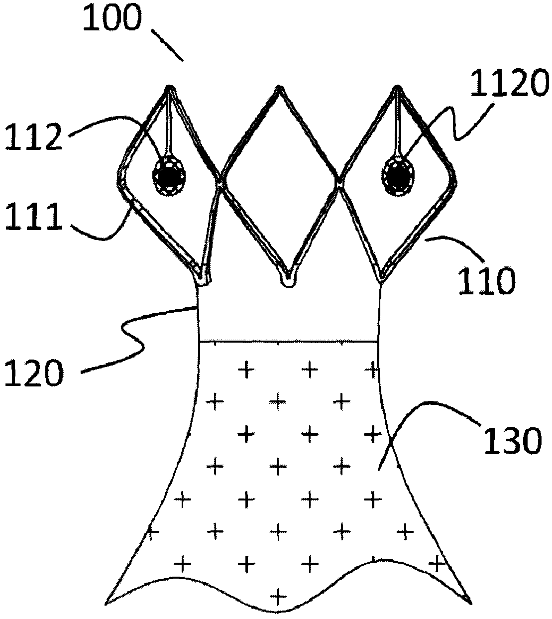 Prosthesis used for preventing valve reflux