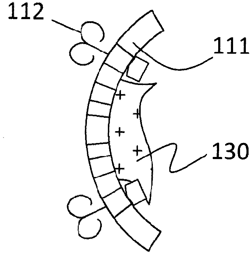 Prosthesis used for preventing valve reflux