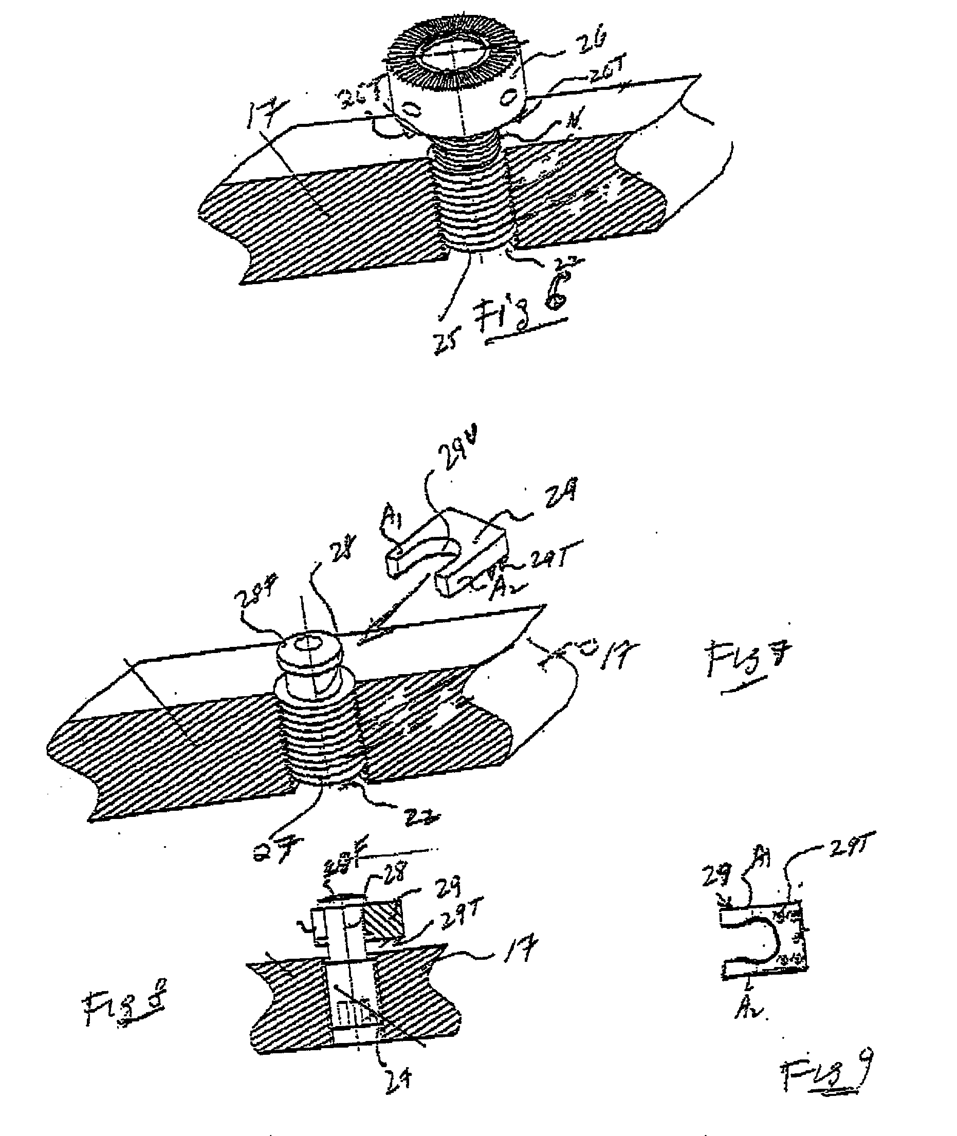 Technique for installing dental implant assembly