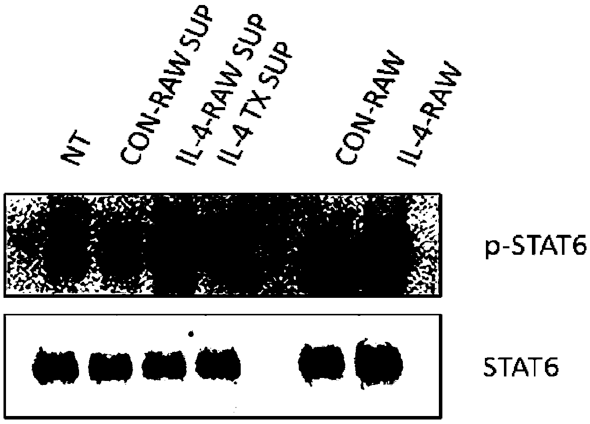 Engineering-transformed macrophages and application of macrophages to septicopyemia