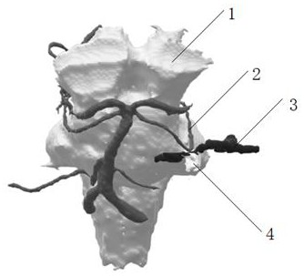 A kind of trigeminal neuralgia model based on mr image and preparation method thereof