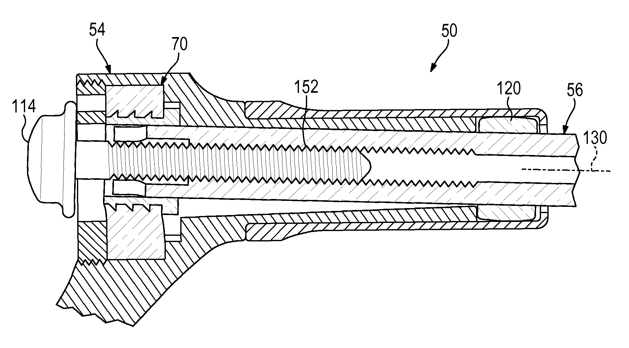 Plate-based compliant hip fixation system