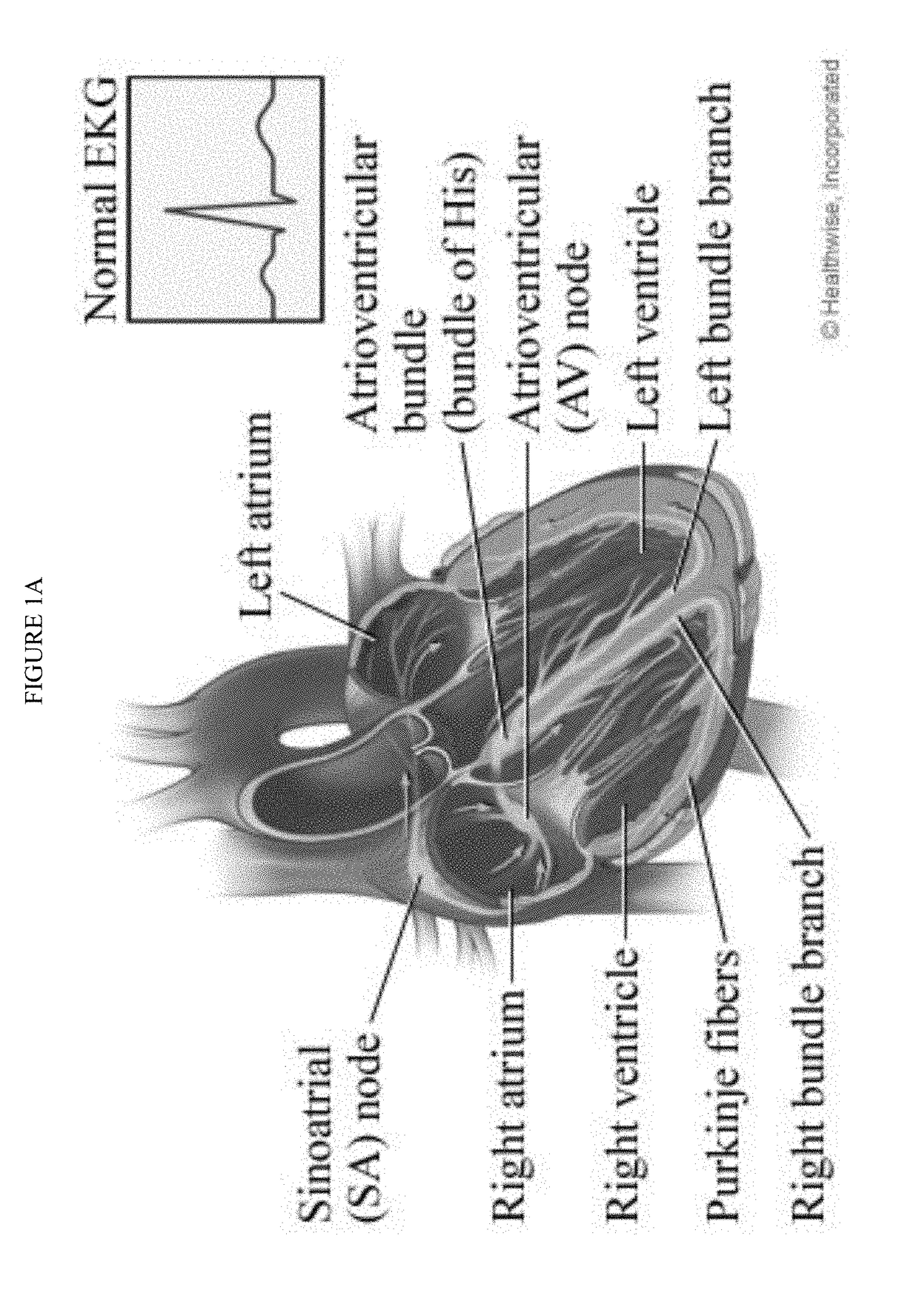 Induced Pacemaker and Purkinje Cells from Adult Stem Cells