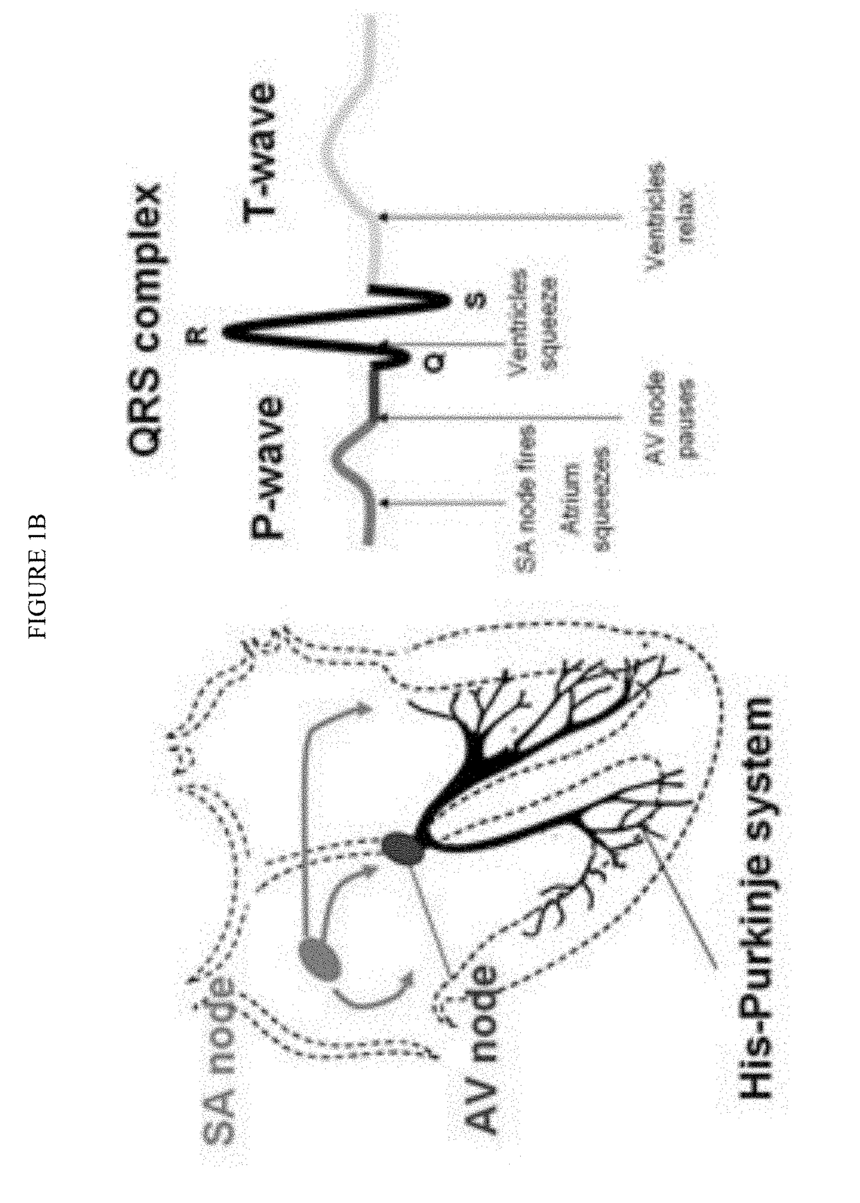 Induced Pacemaker and Purkinje Cells from Adult Stem Cells