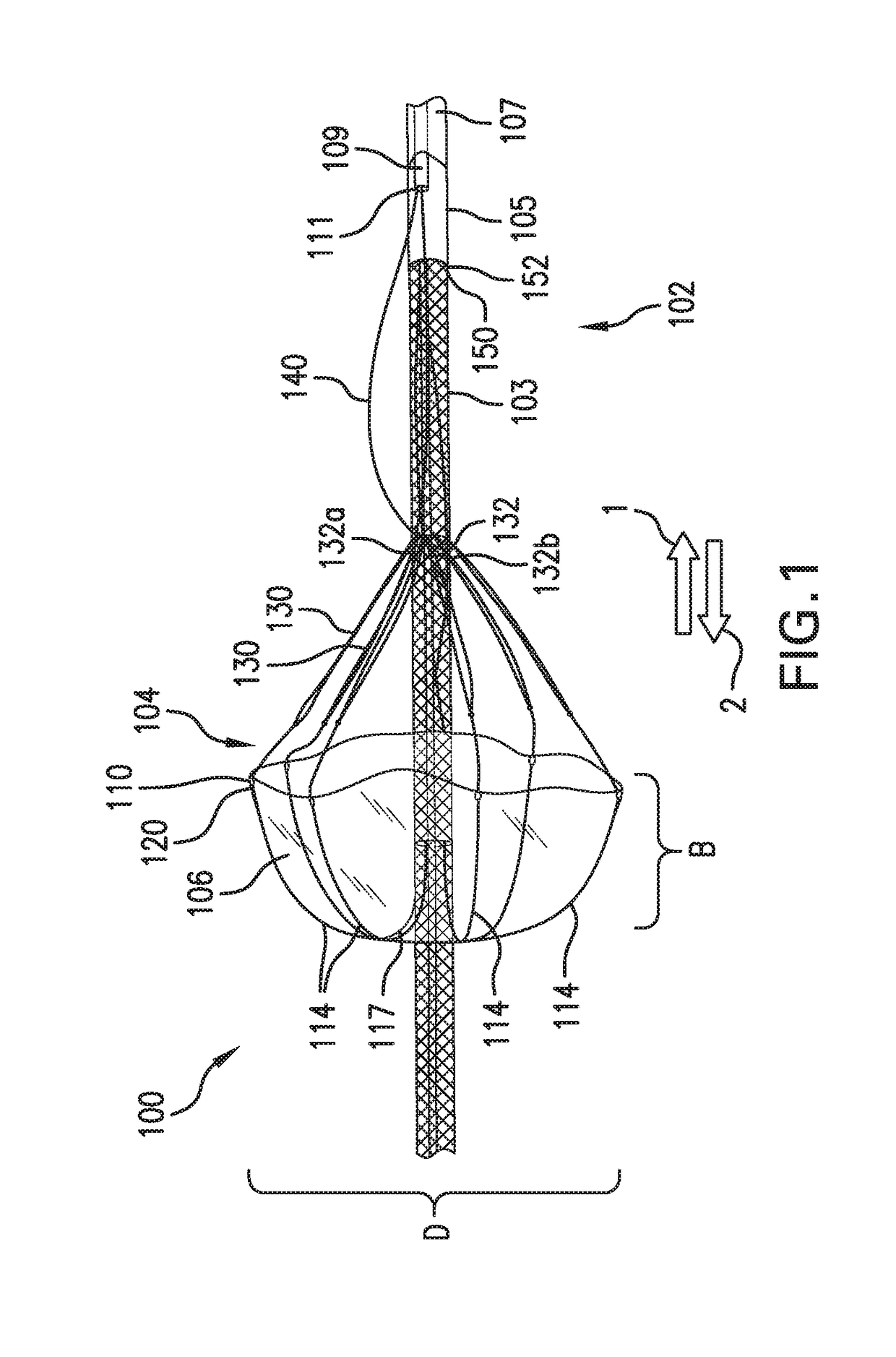 Inverting Temporary Valve Sheath