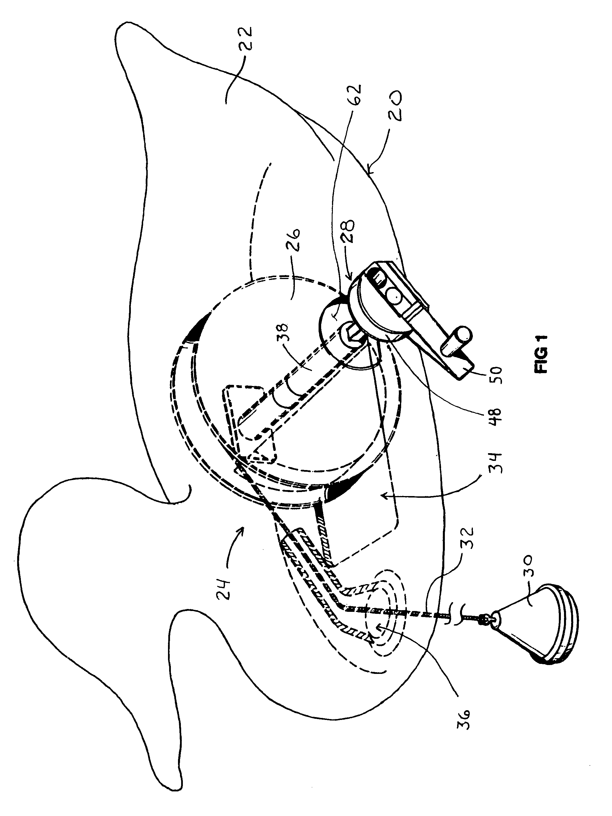 Self-righting waterfowl decoy with integrated anchor and locking mechanism