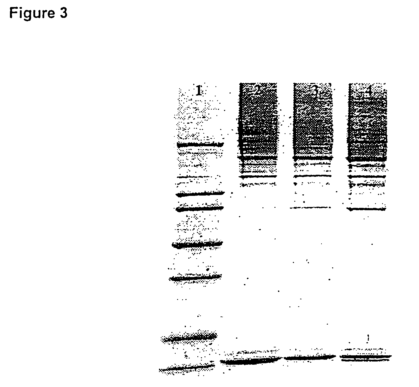 Conjugates of galactose-binding lectins and clostridial neurotoxins as analgesics