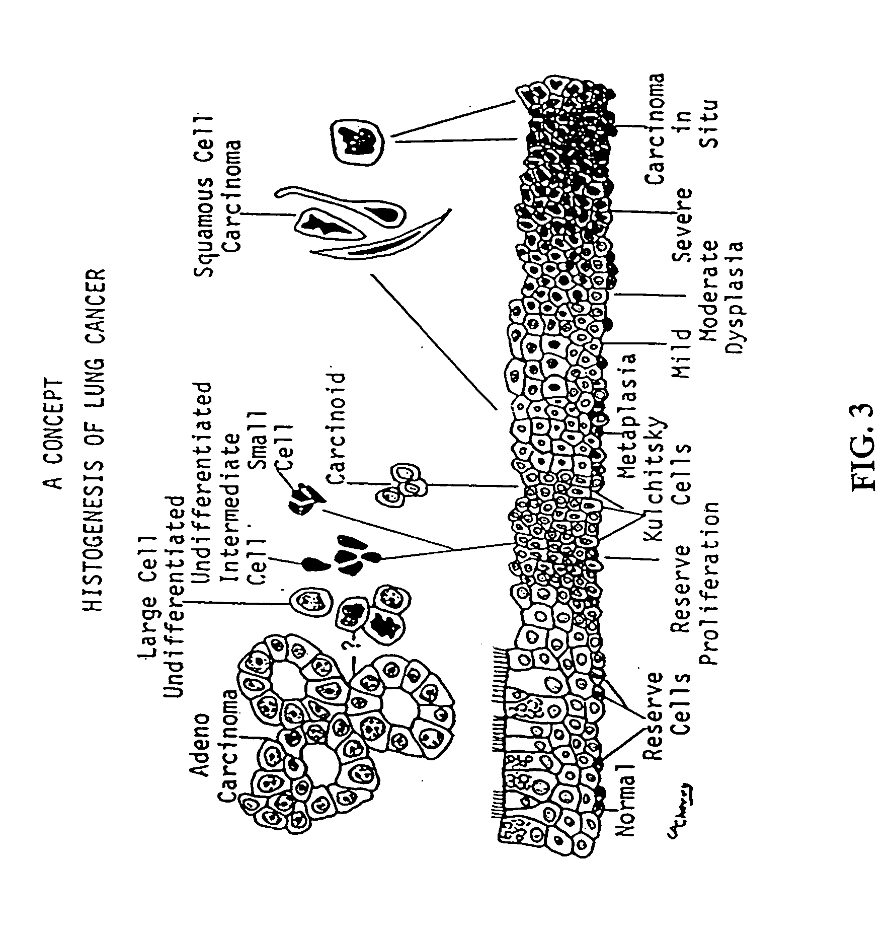 Detection and diagnosis of smoking related cancers