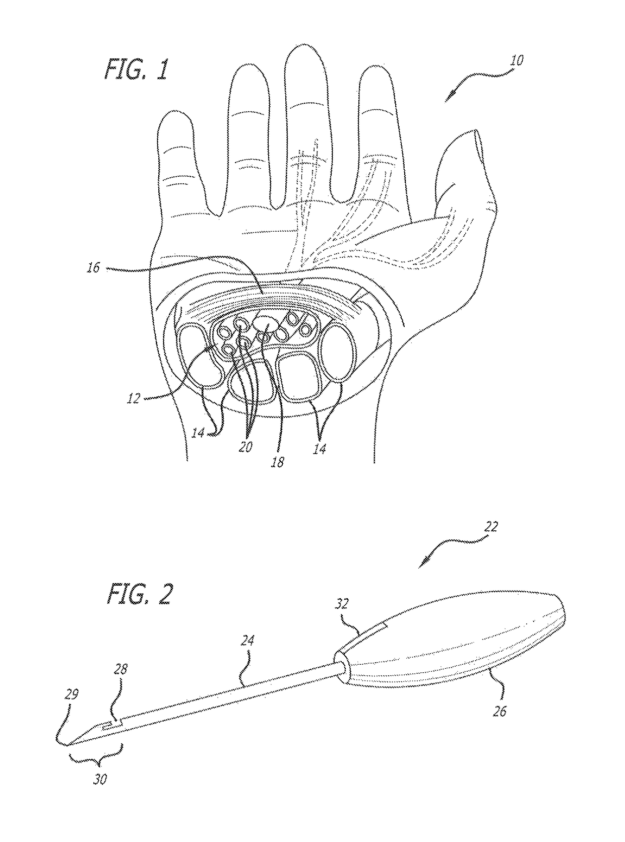 Methods for thread transection of a soft tissue