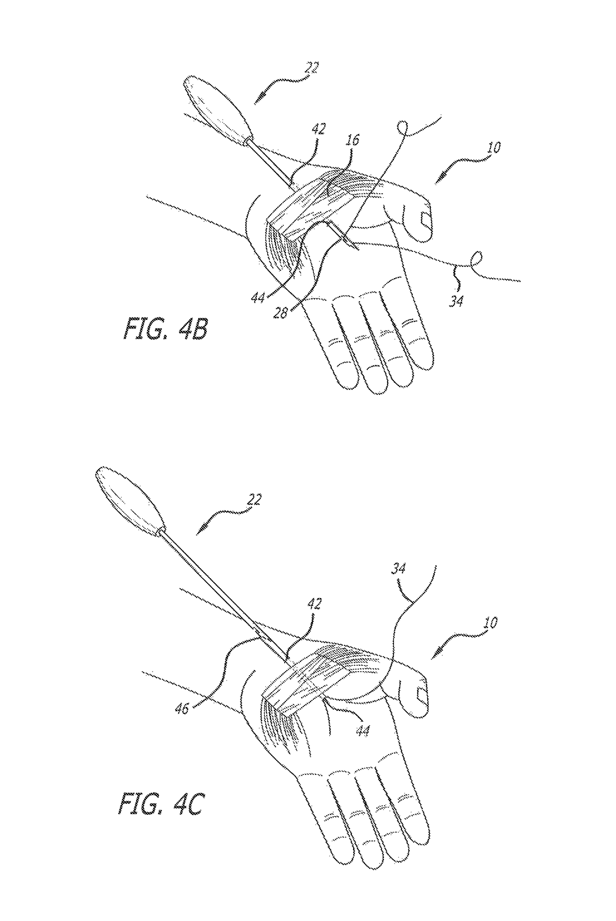 Methods for thread transection of a soft tissue