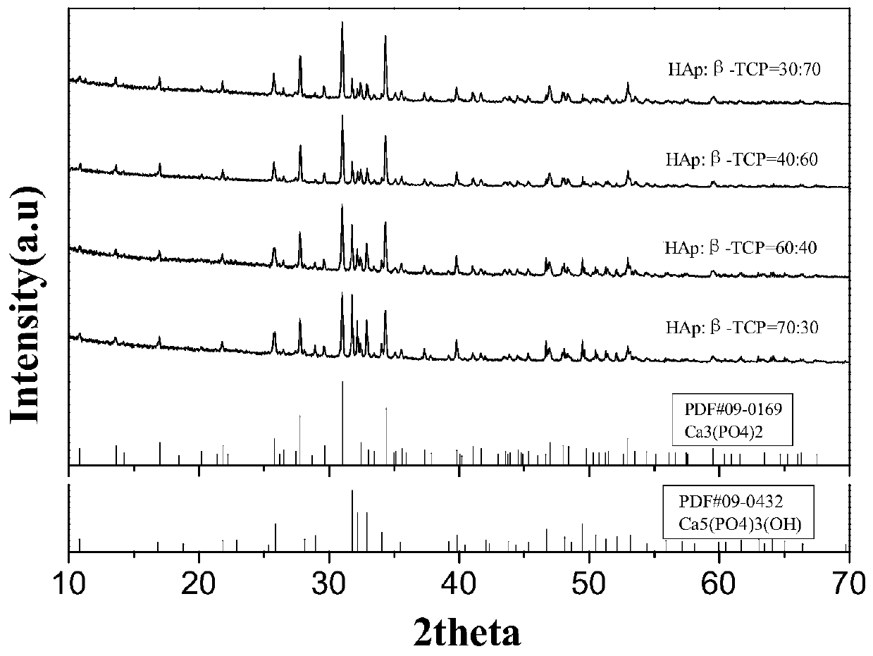 Preparation method of biphasic calcium phosphate composite powder synthesized by high-temperature solid-state reaction