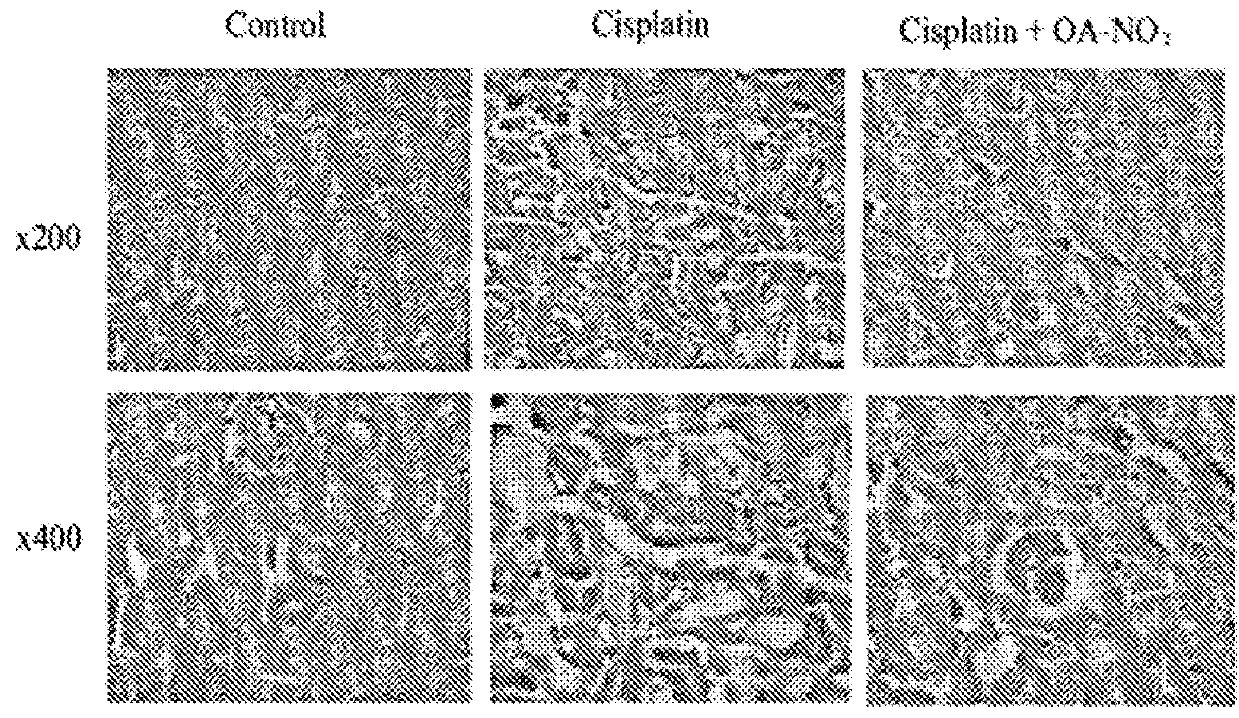 Use of nitrated lipids for treatment of side effects of toxic medical therapies