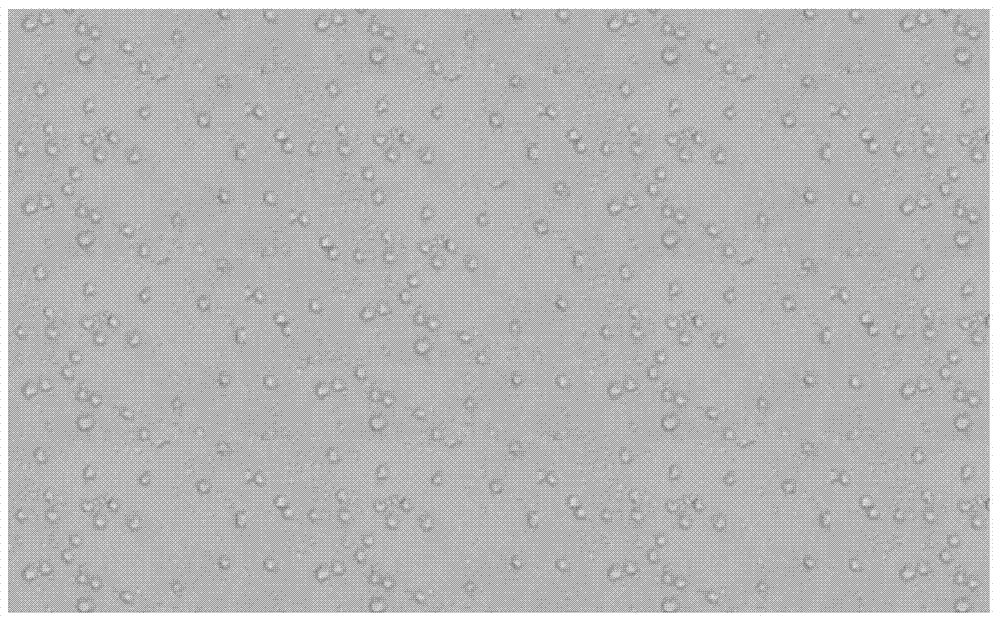 Preparation method of human dendritic cell tumour vaccine