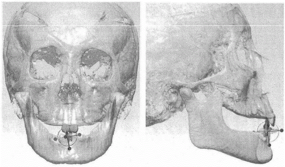 Digital tooth arrangement method based on tooth root information