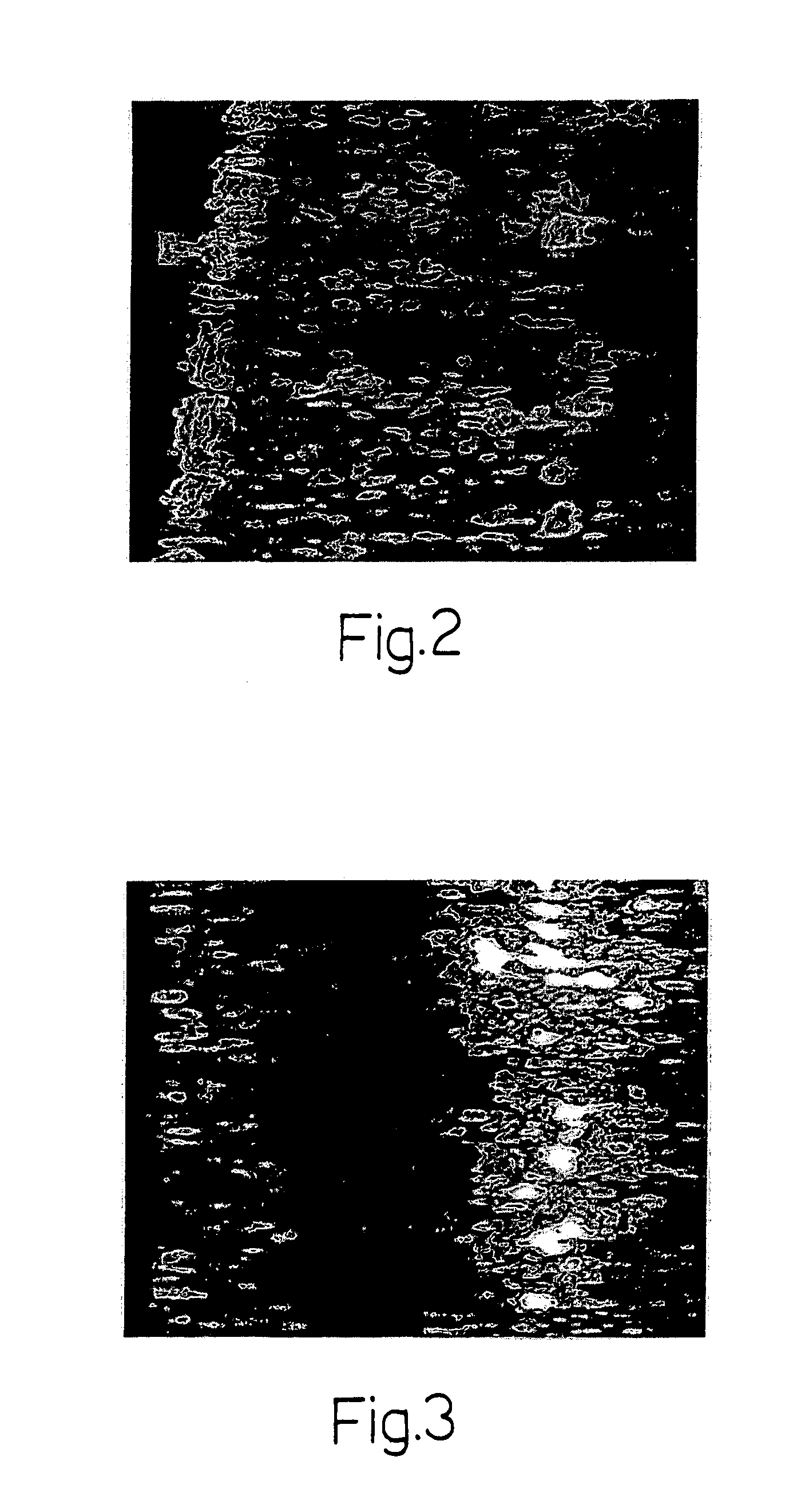 Cosmetic treatment and relative apparatus