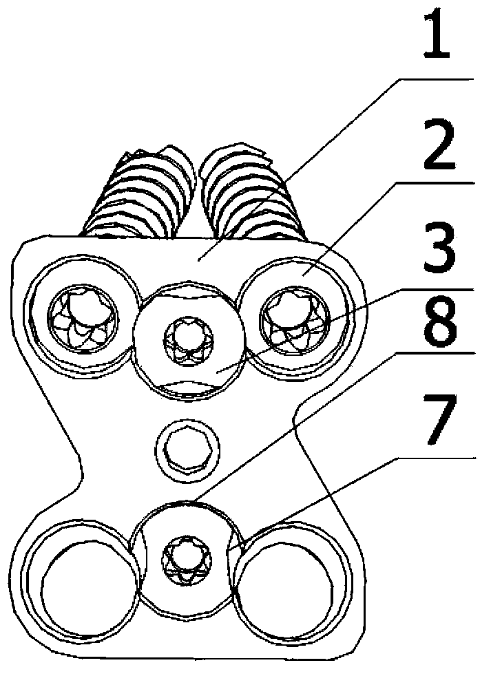 Lumbosacral anterior plate fixing device