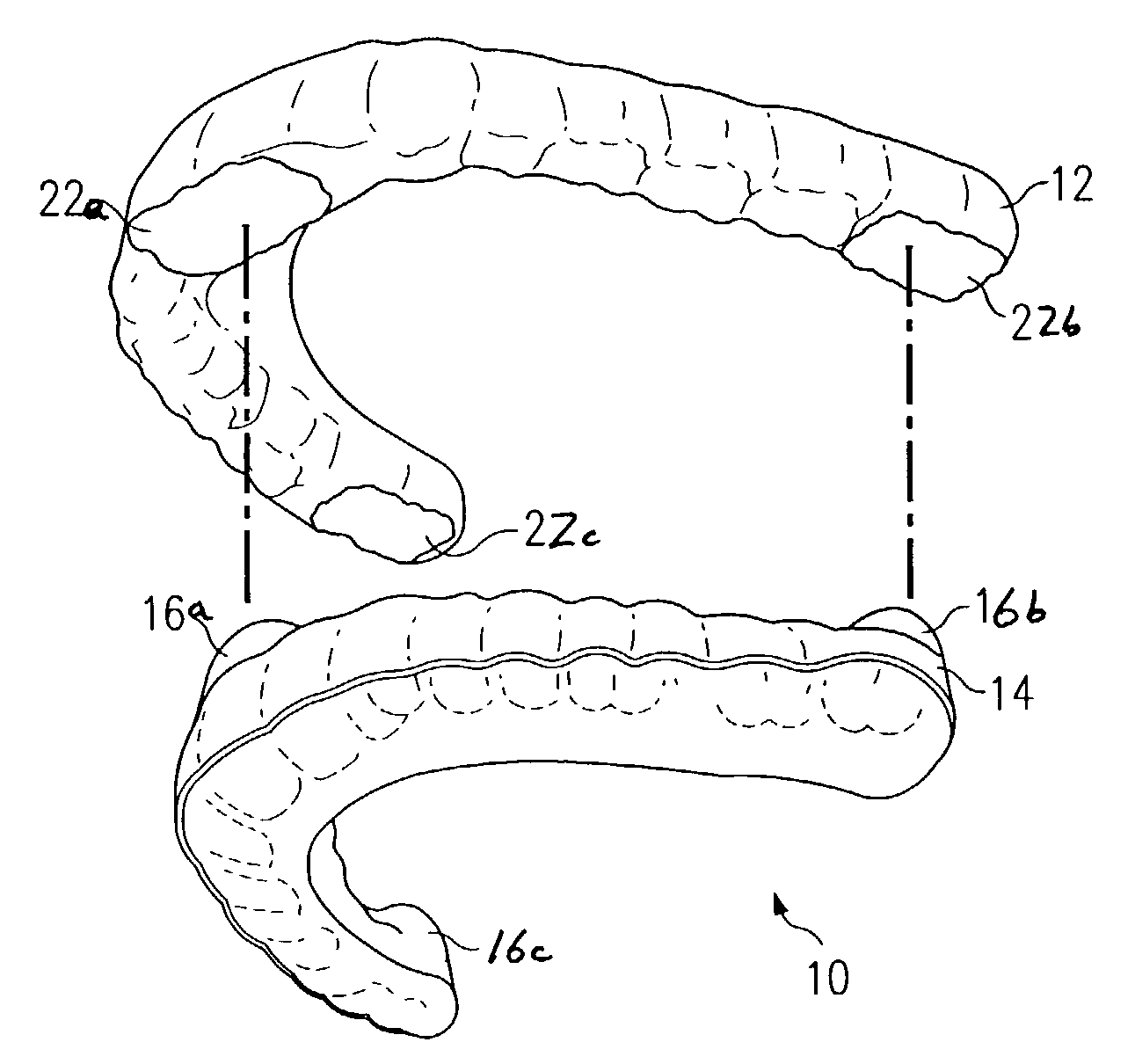 Oral appliance for maintaining stability of one or more aspects of a user's masticatory system