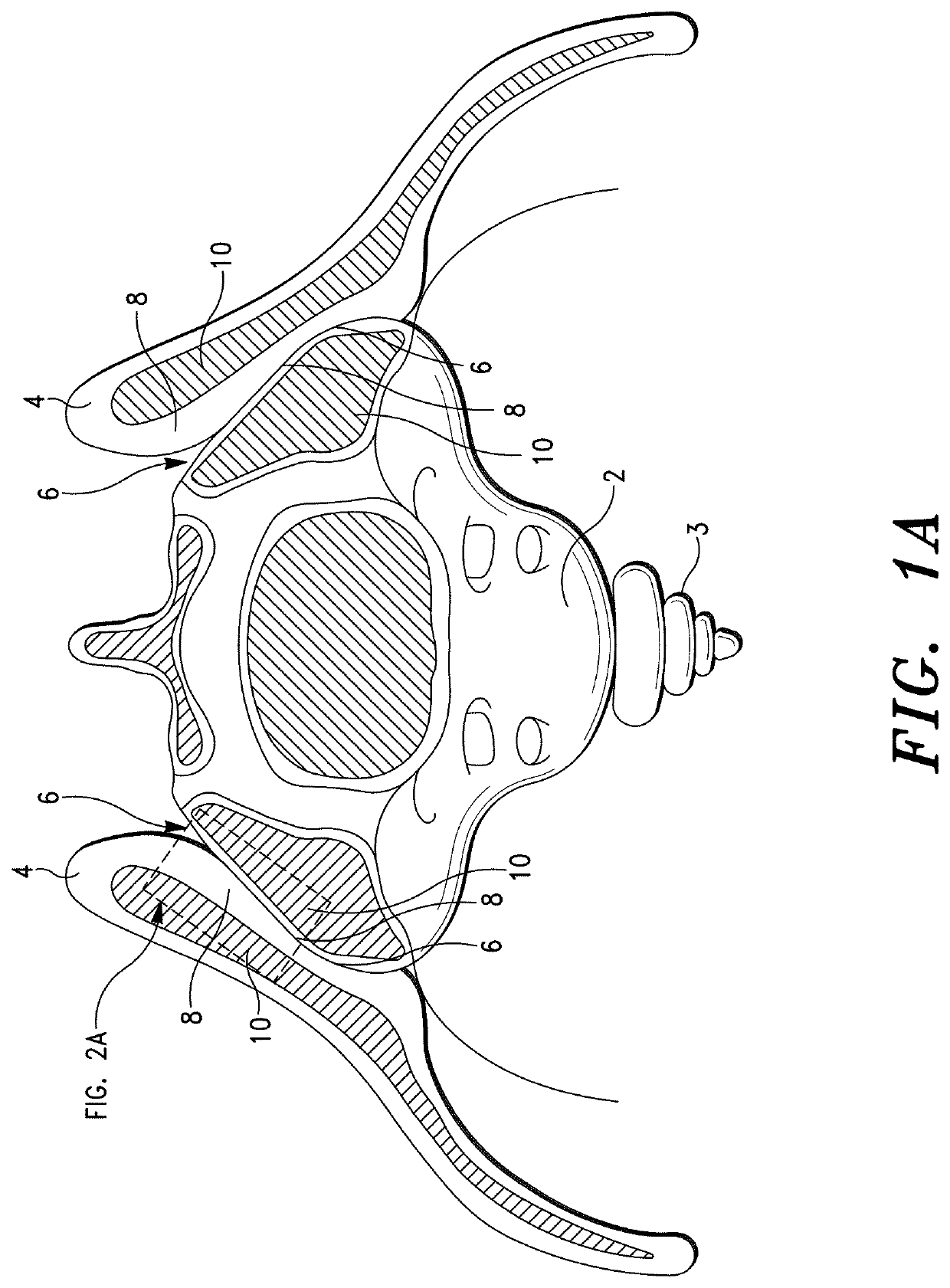 Sacroiliac Joint Stabilization Prostheses