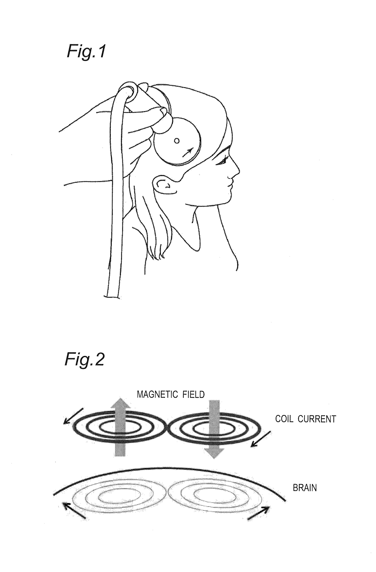 Coil device and transcranial magnetic stimulation system