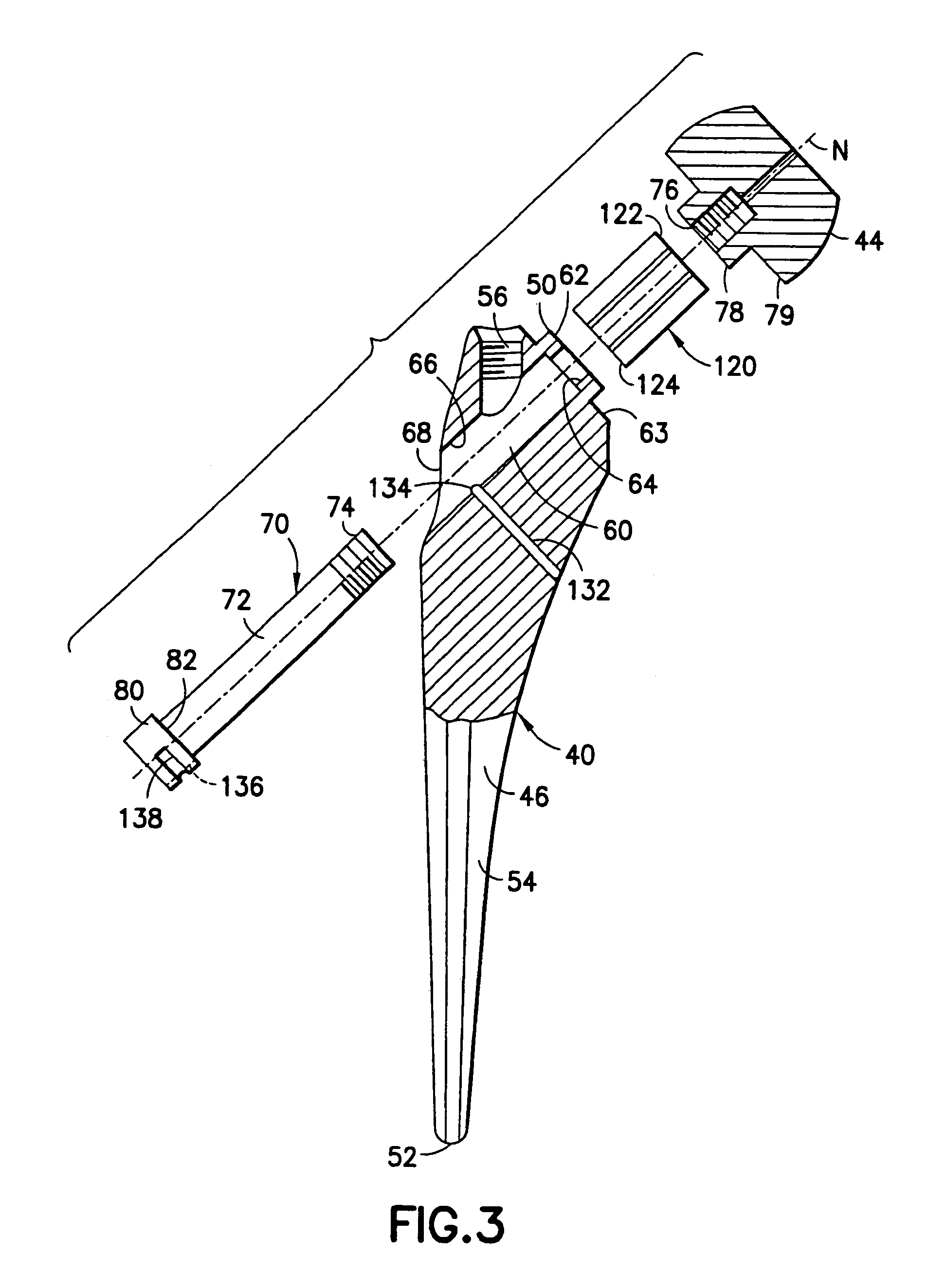 Hip arthroplasty trialing apparatus and method