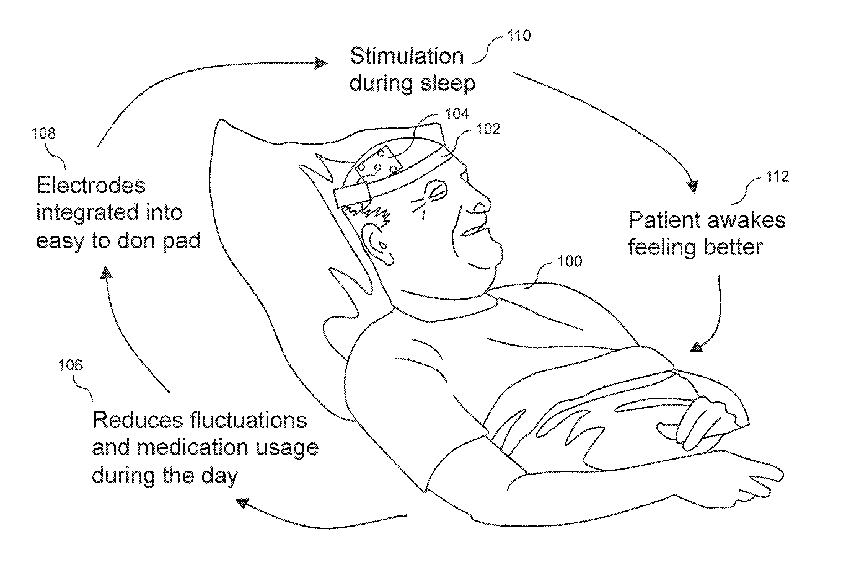 Wearable, unsupervised transcranial direct current stimulation (tDCS) device for movement disorder therapy, and method of using